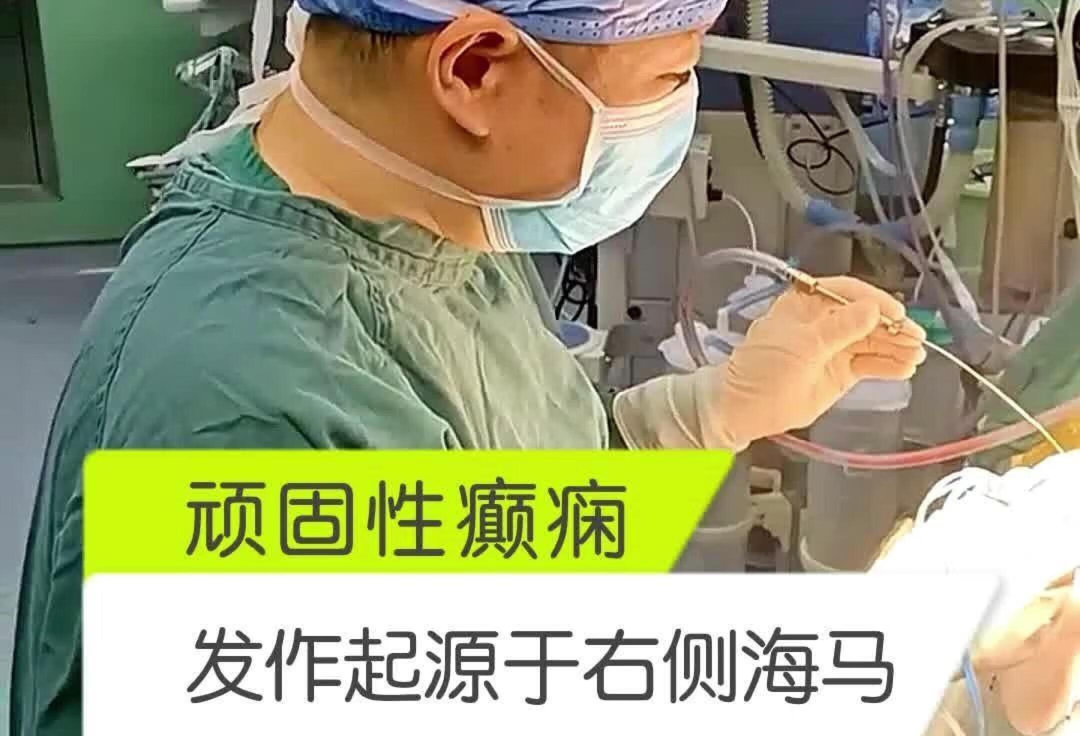 难治性癫痫