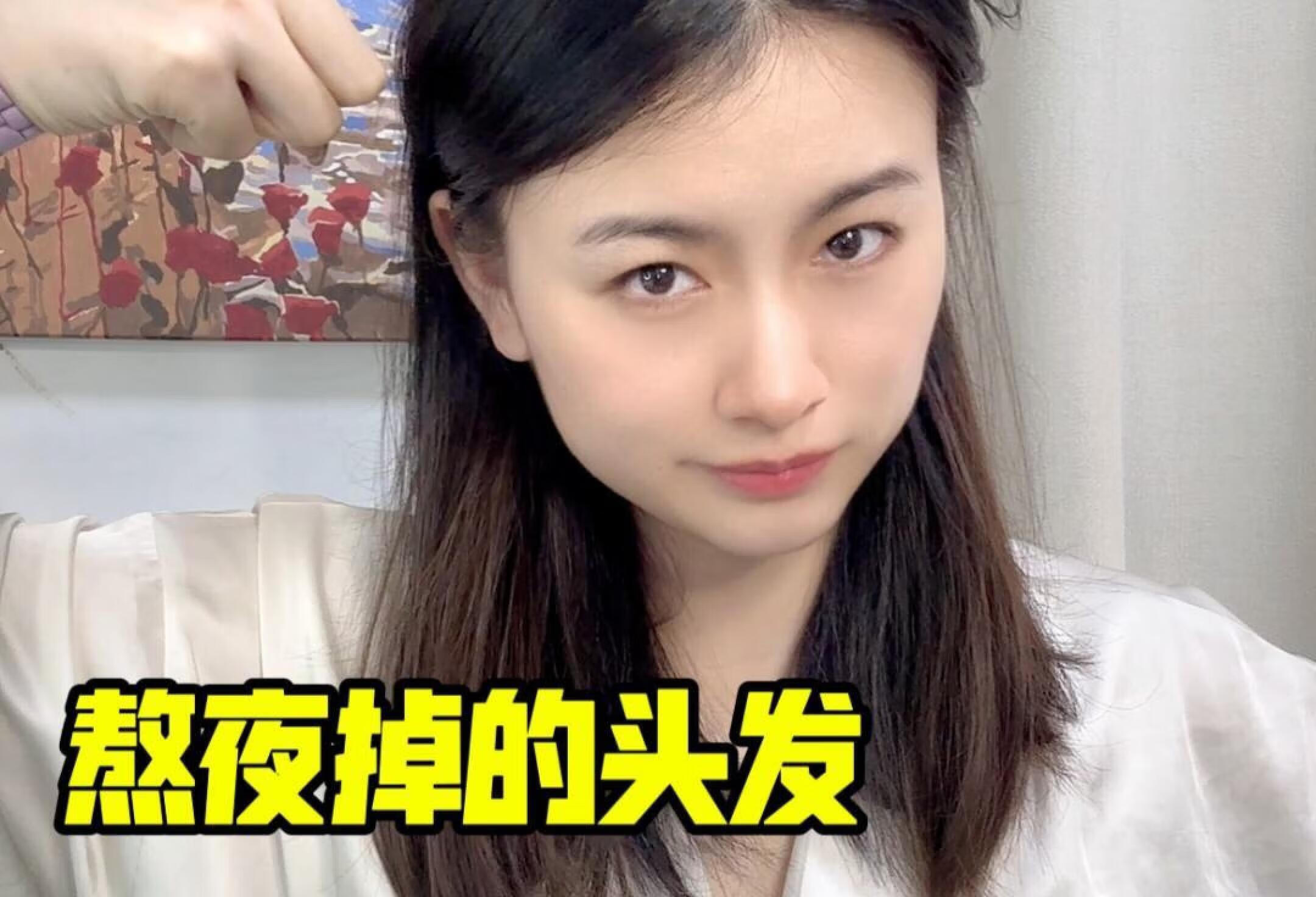 戒掉熬夜头发还能回来吗？