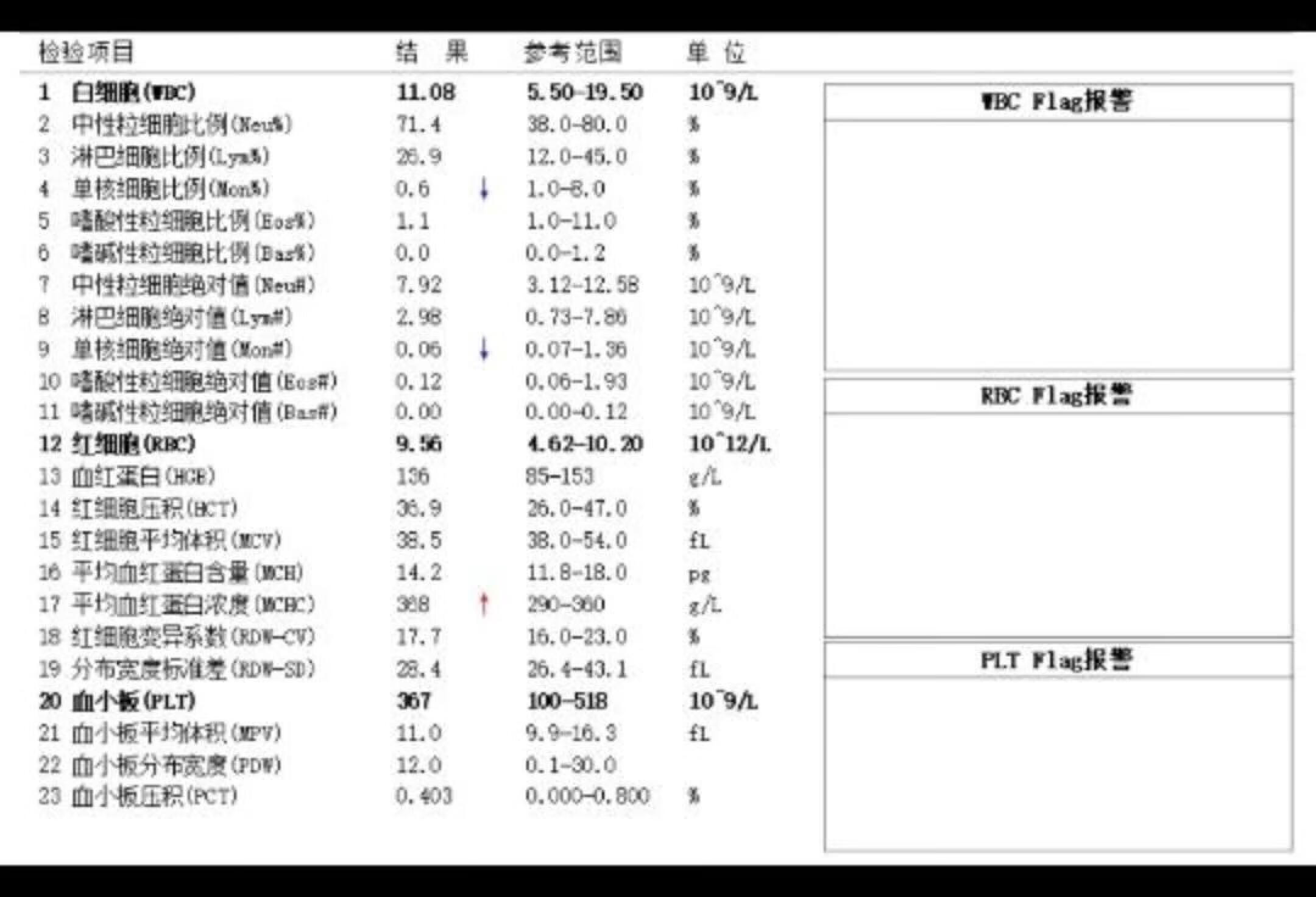 多发性肌炎