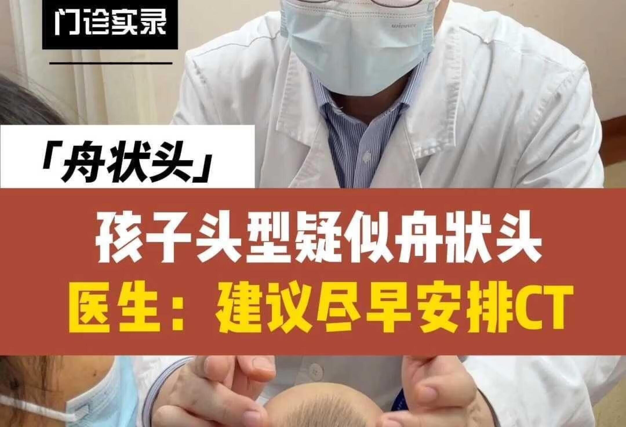 孩子头型疑似舟状头，尽早安排ct检查