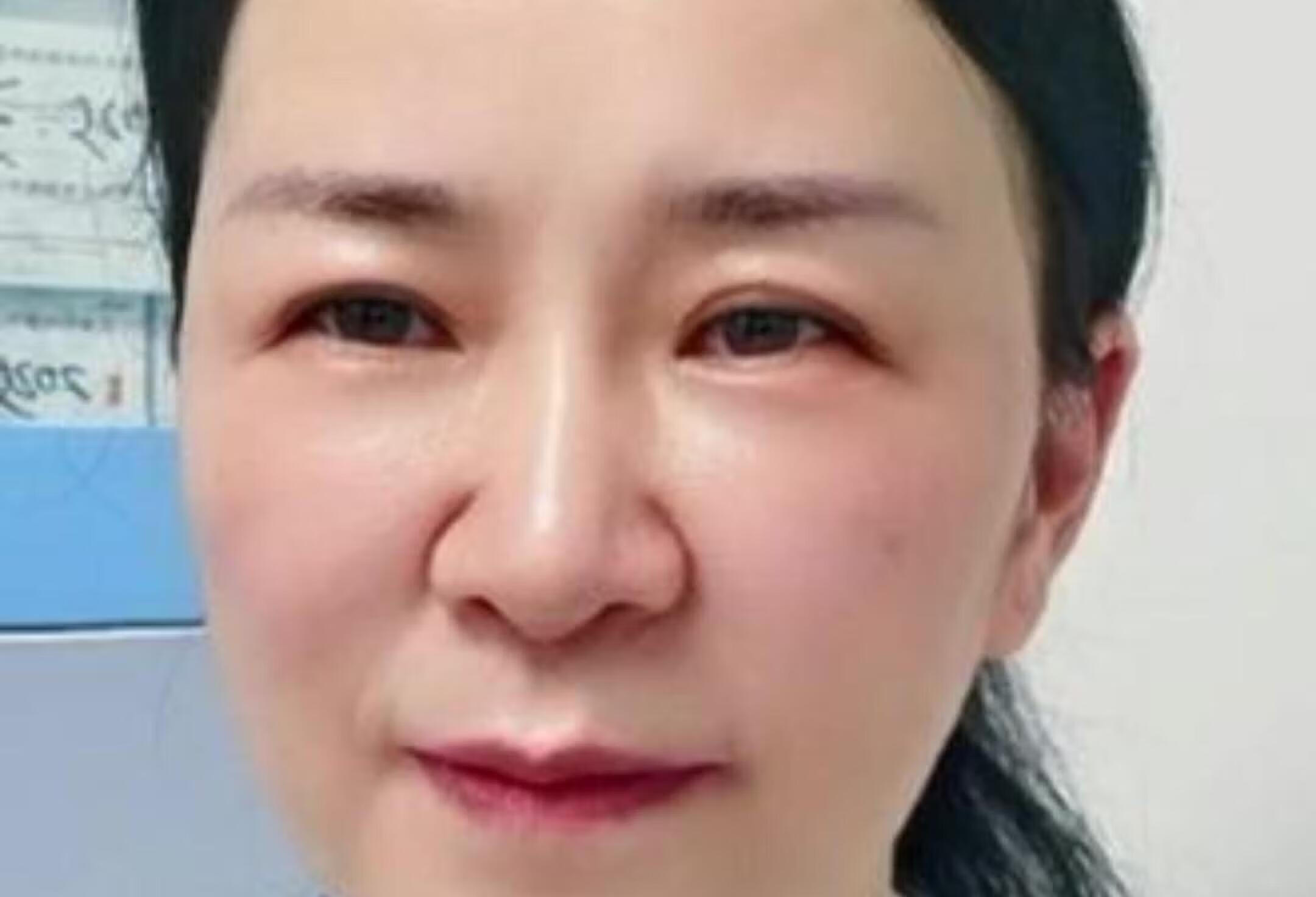 孕妇感染GBS对新生儿有哪些危害？