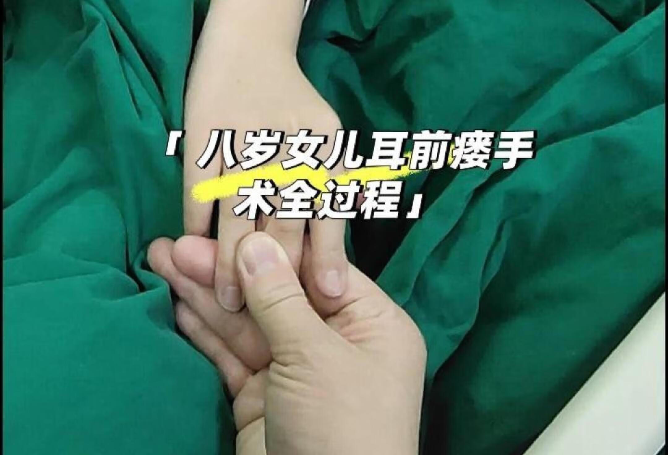 八岁女儿耳前瘘手术全过程