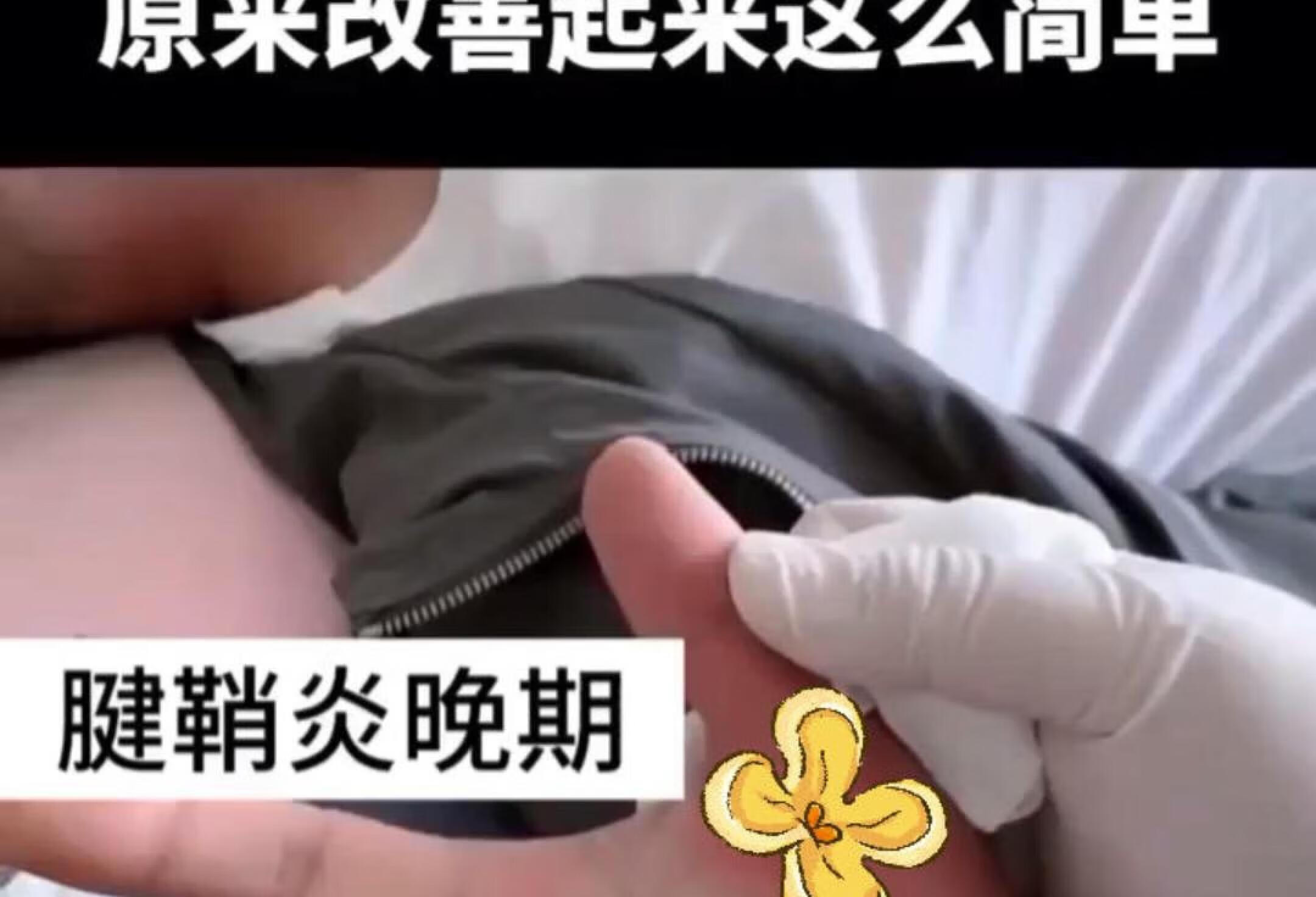 腱鞘炎问题别放任不管，原来可以这样去改善！