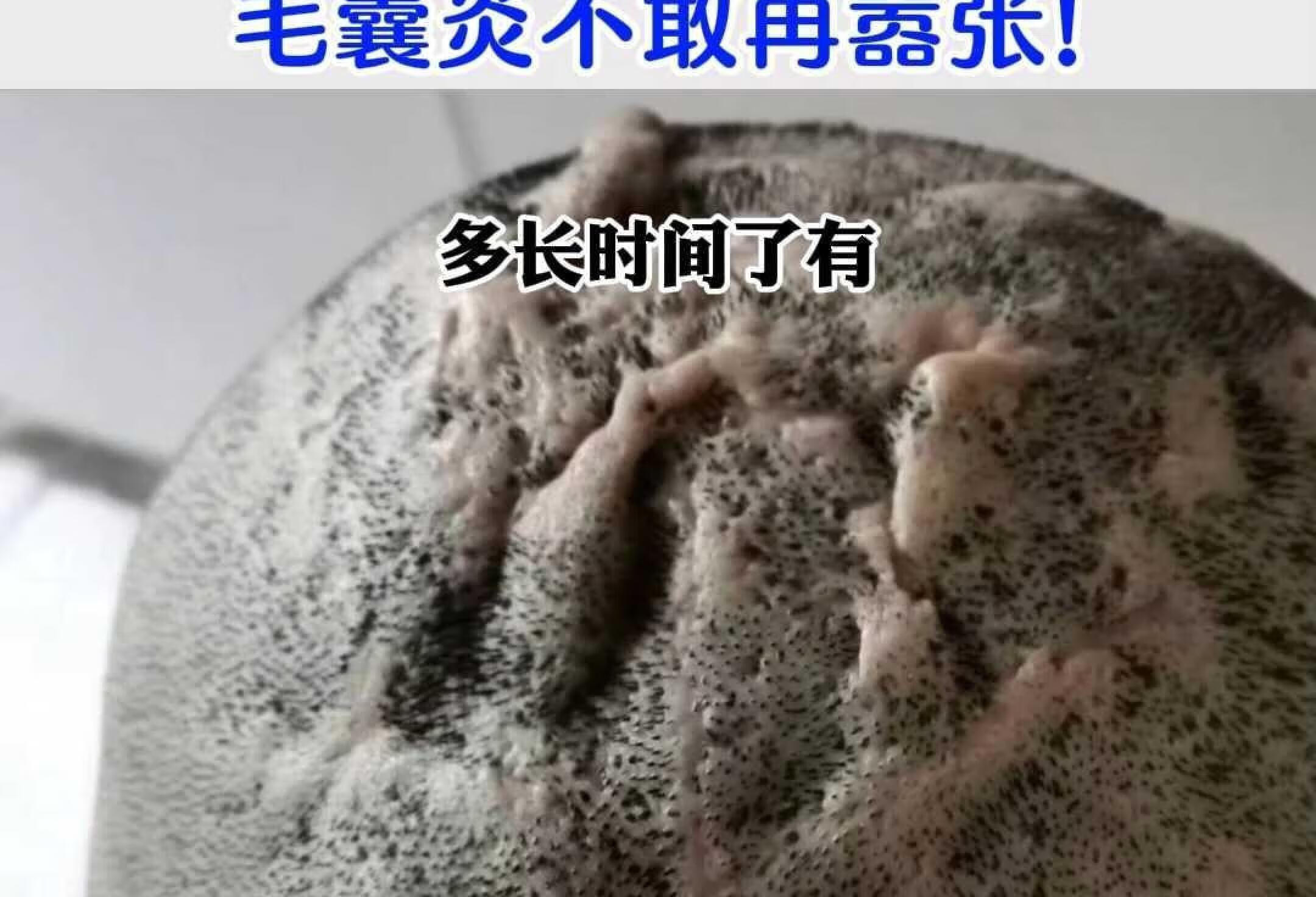 9年的毛囊炎，经络通了，毛囊炎不敢再嚣张!