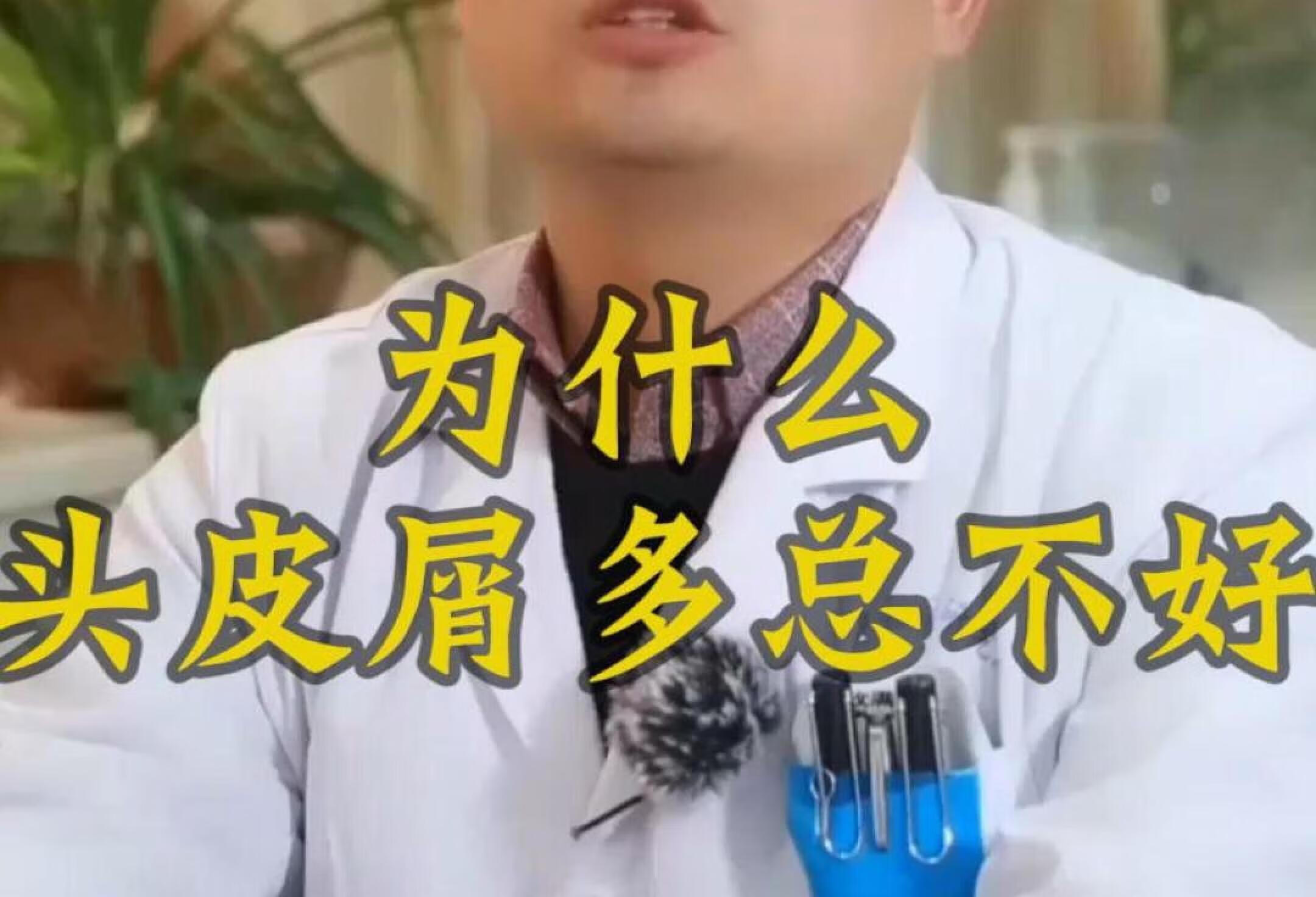 头皮屑多是什么原因