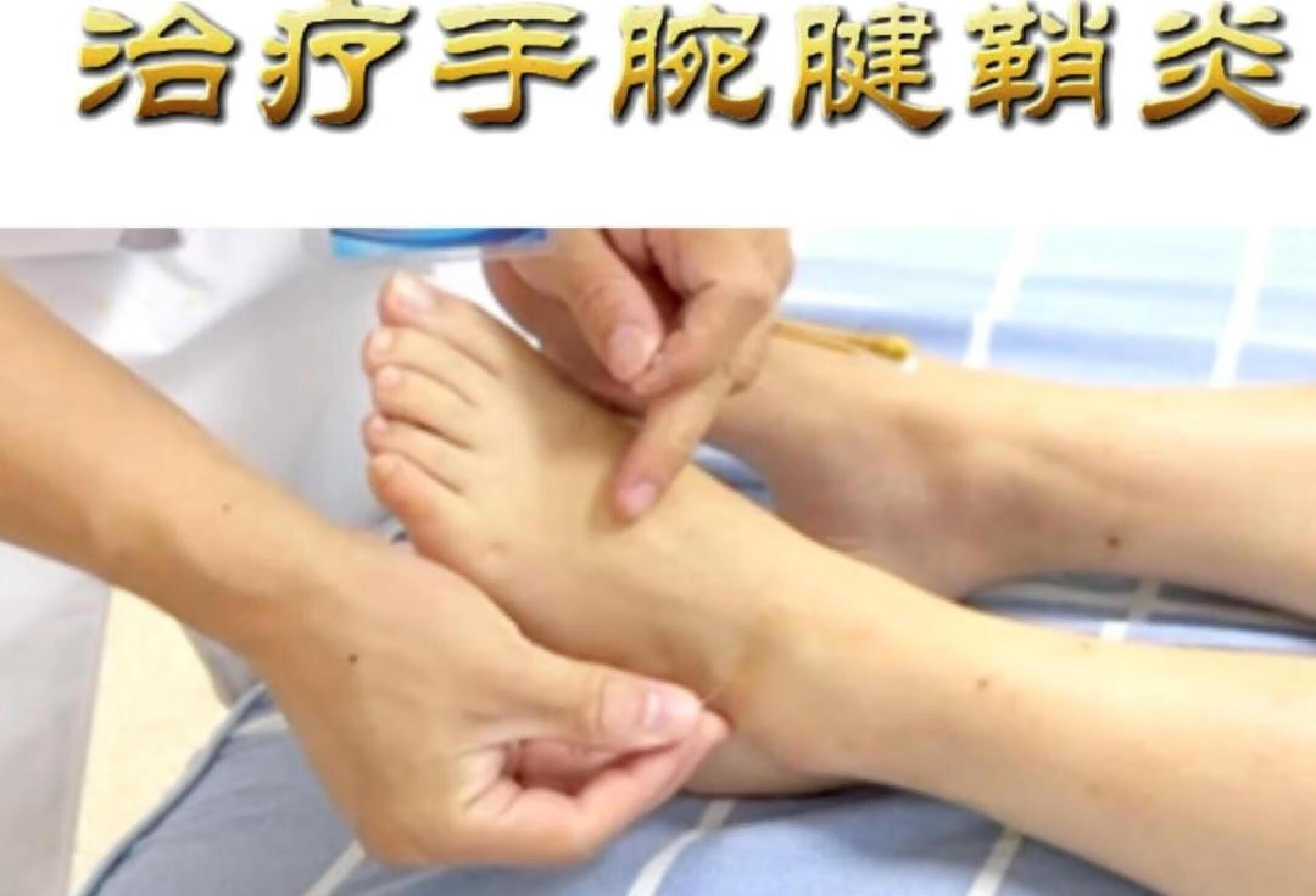 小姐姐抱小孩导致手腕痛，来做针灸，立竿见影