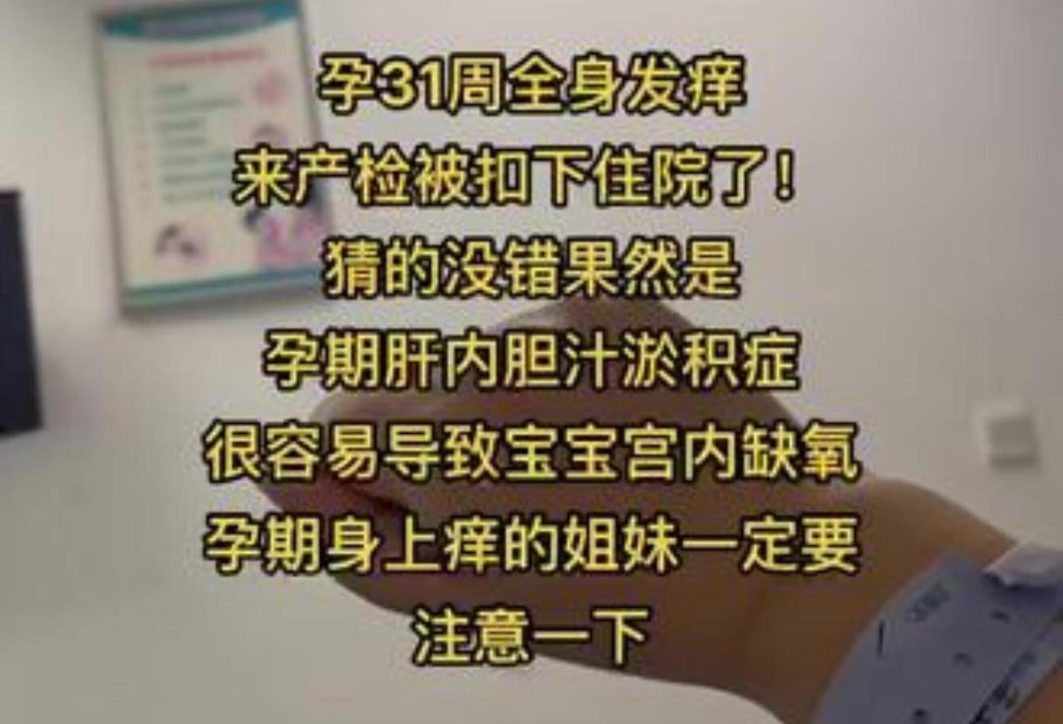 一个身体两个心跳 怀孕 孕期记录 肝内胆汁淤积症