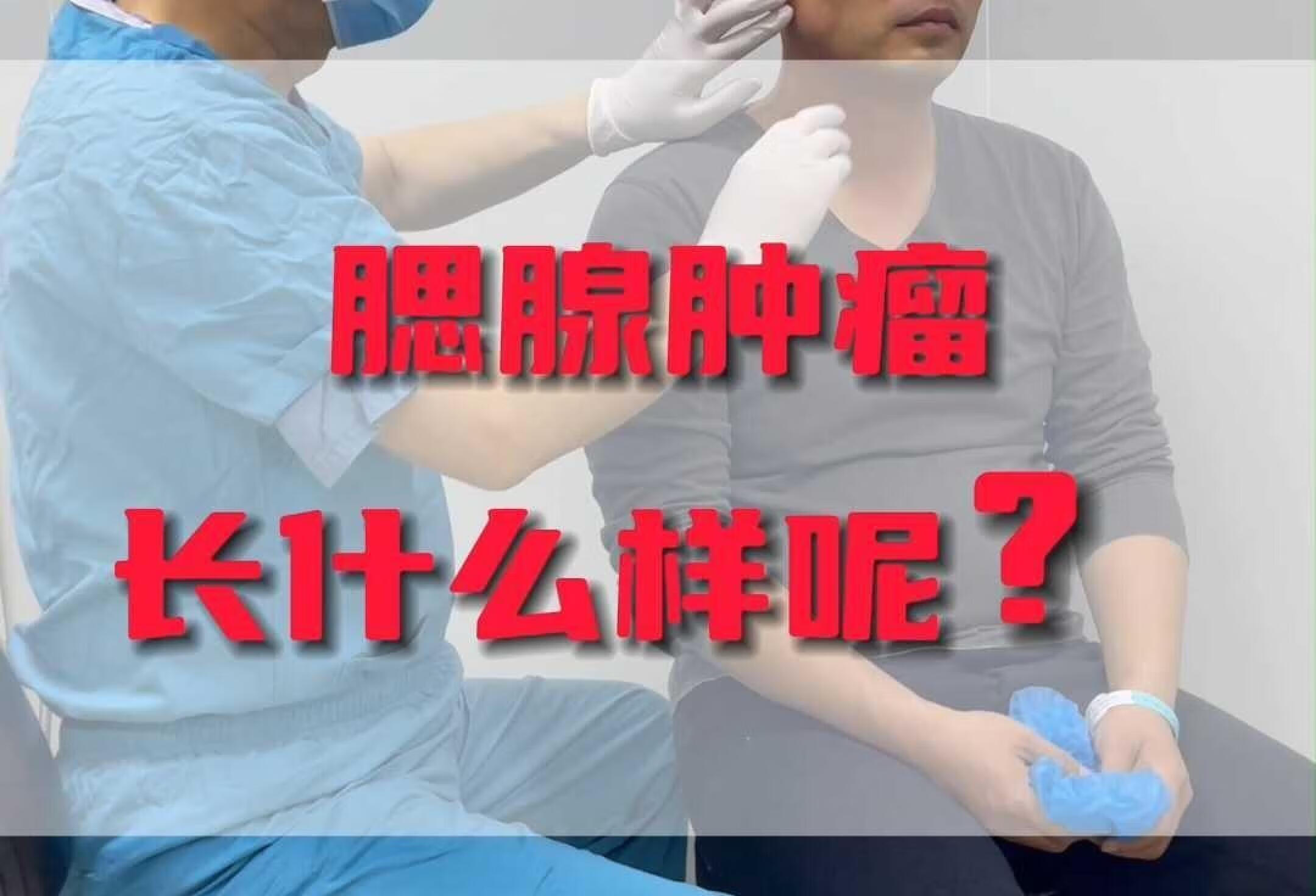 三年前长大的腮腺肿瘤