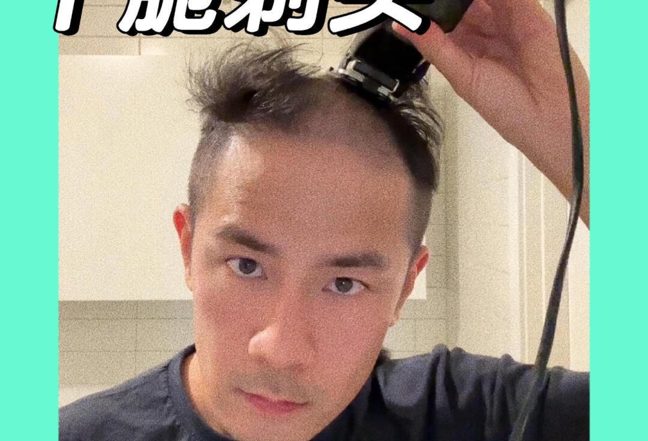 💇🏻‍♂️脂溢性脱发决定剃寸头（更不开心了）