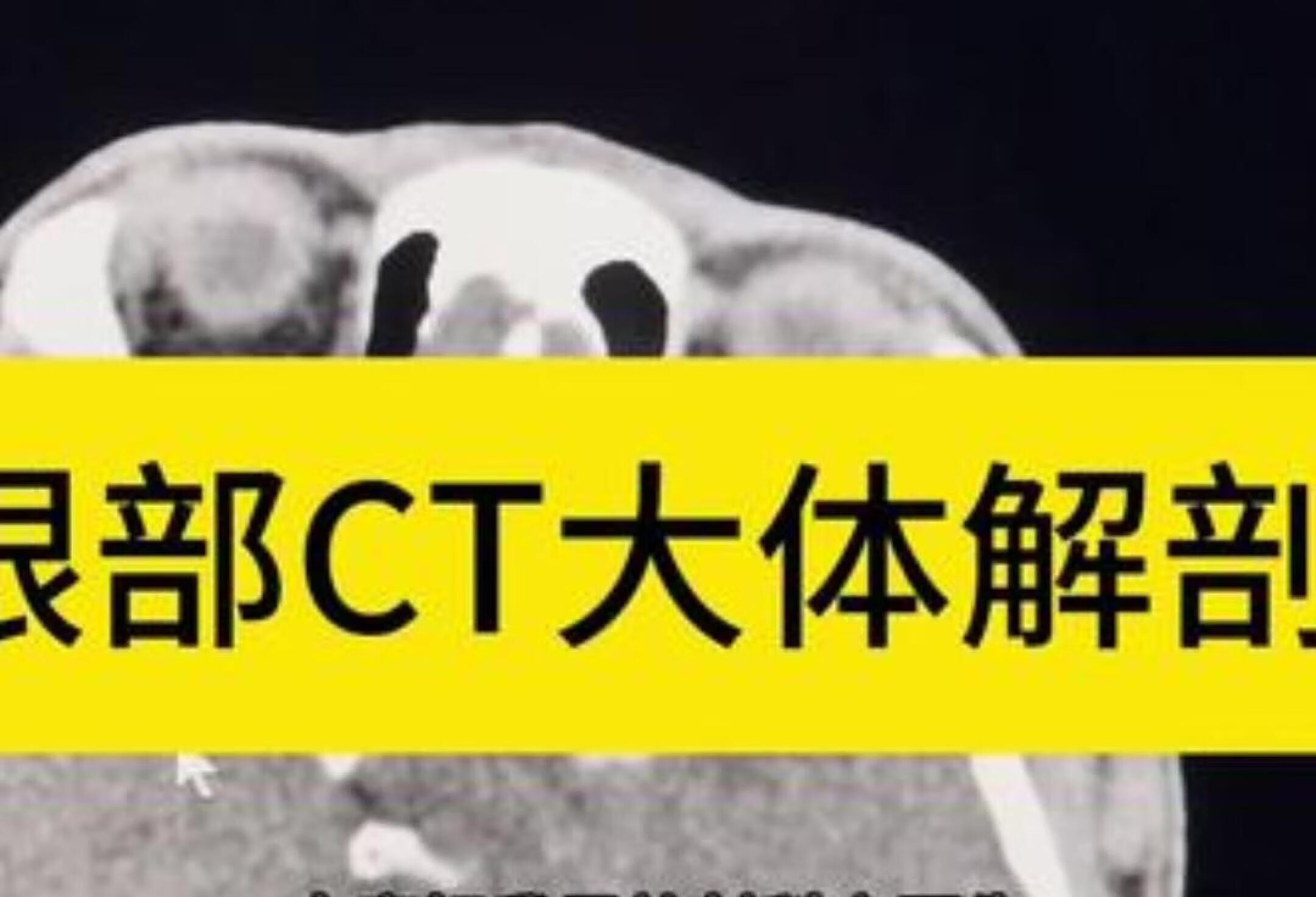 眼部CT大揭秘，解剖与疾病全解析