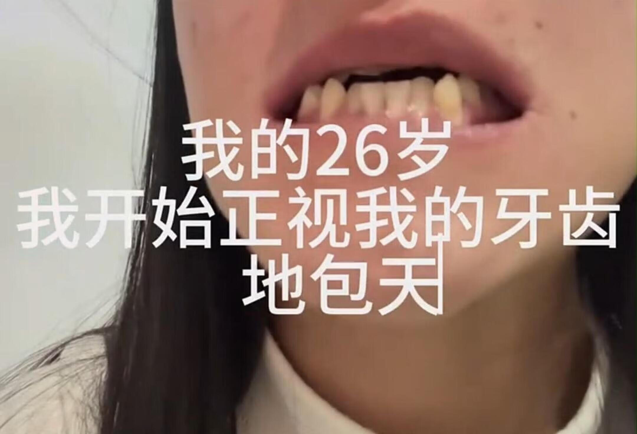 开心~重获新生的感觉