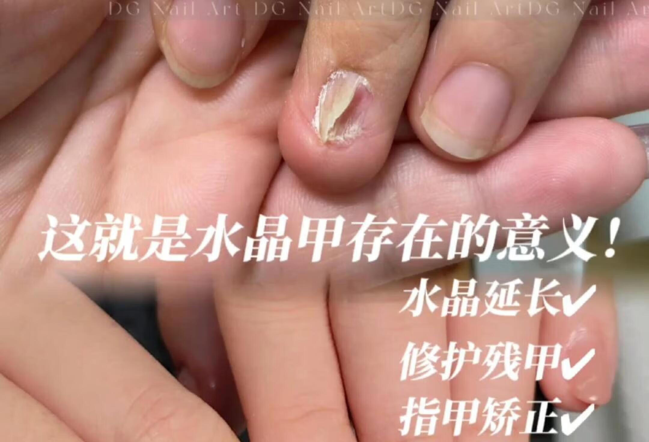 这就是水晶甲存在的意义吧