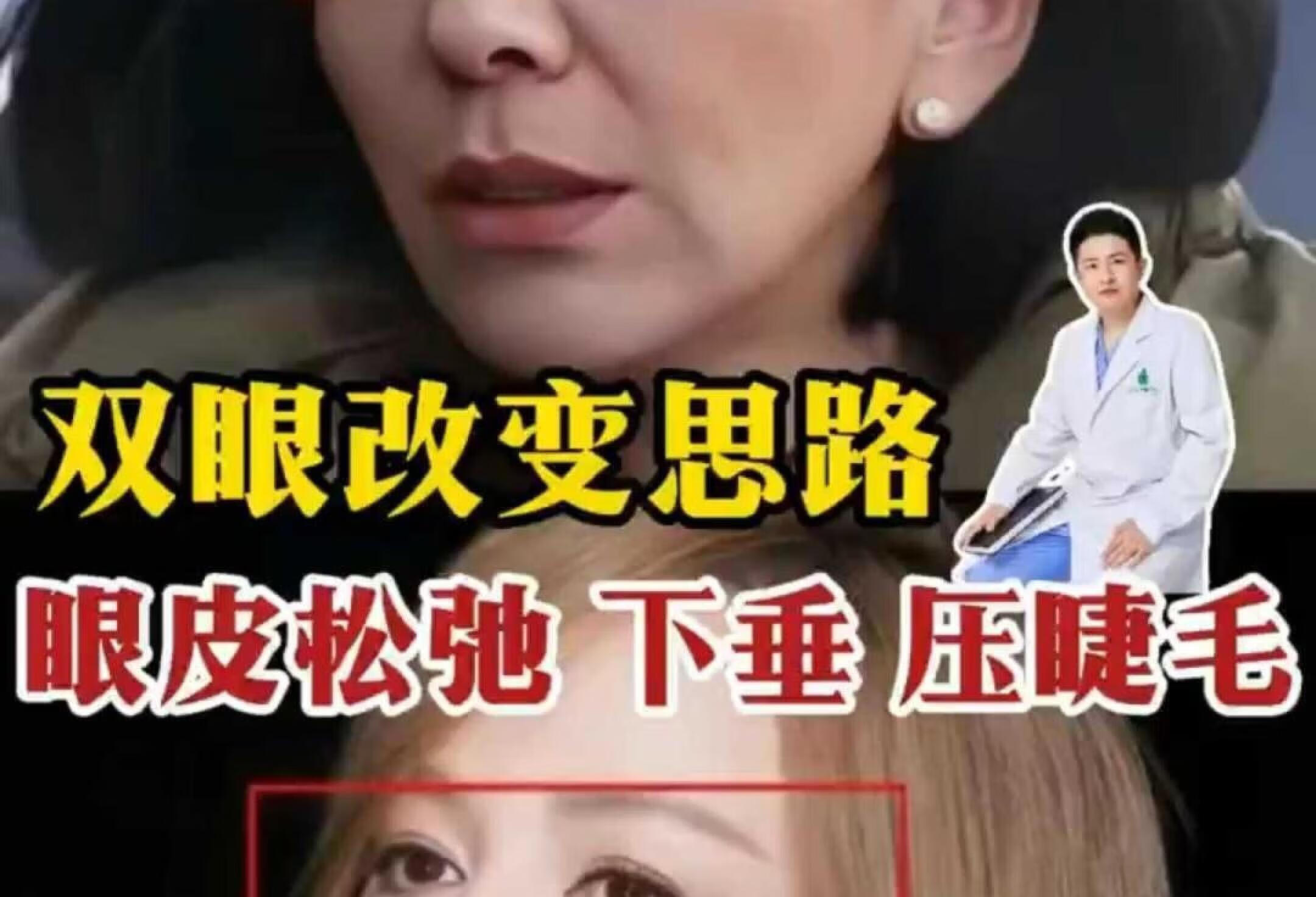 你见过正面看不到睫毛的👀吗？