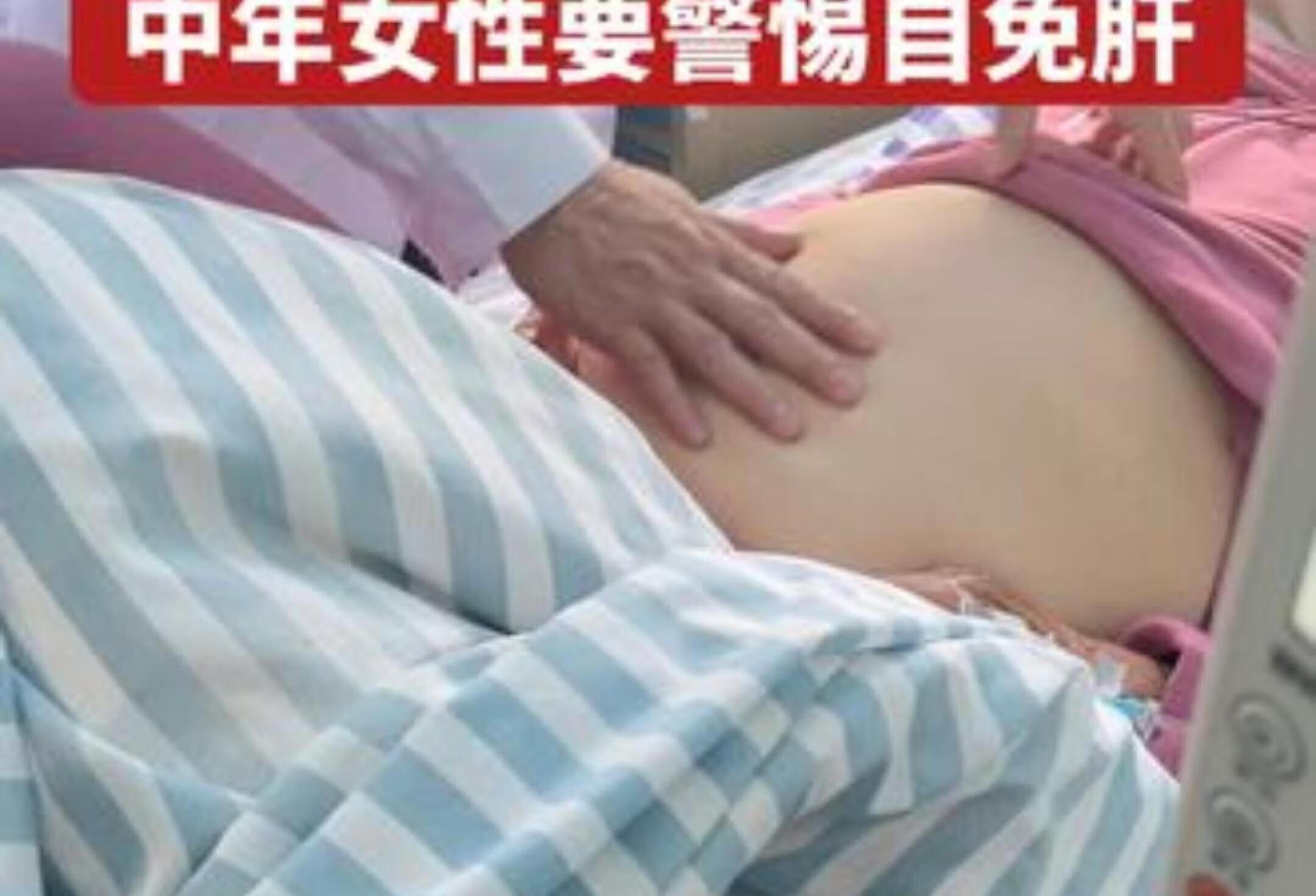 自免肝 胆汁性肝硬化 肝硬化腹水 女性疾病