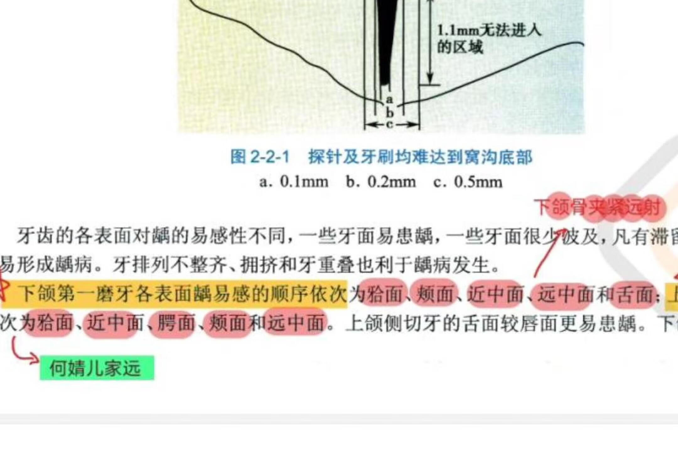 牙体牙髓 无敌口诀! day1