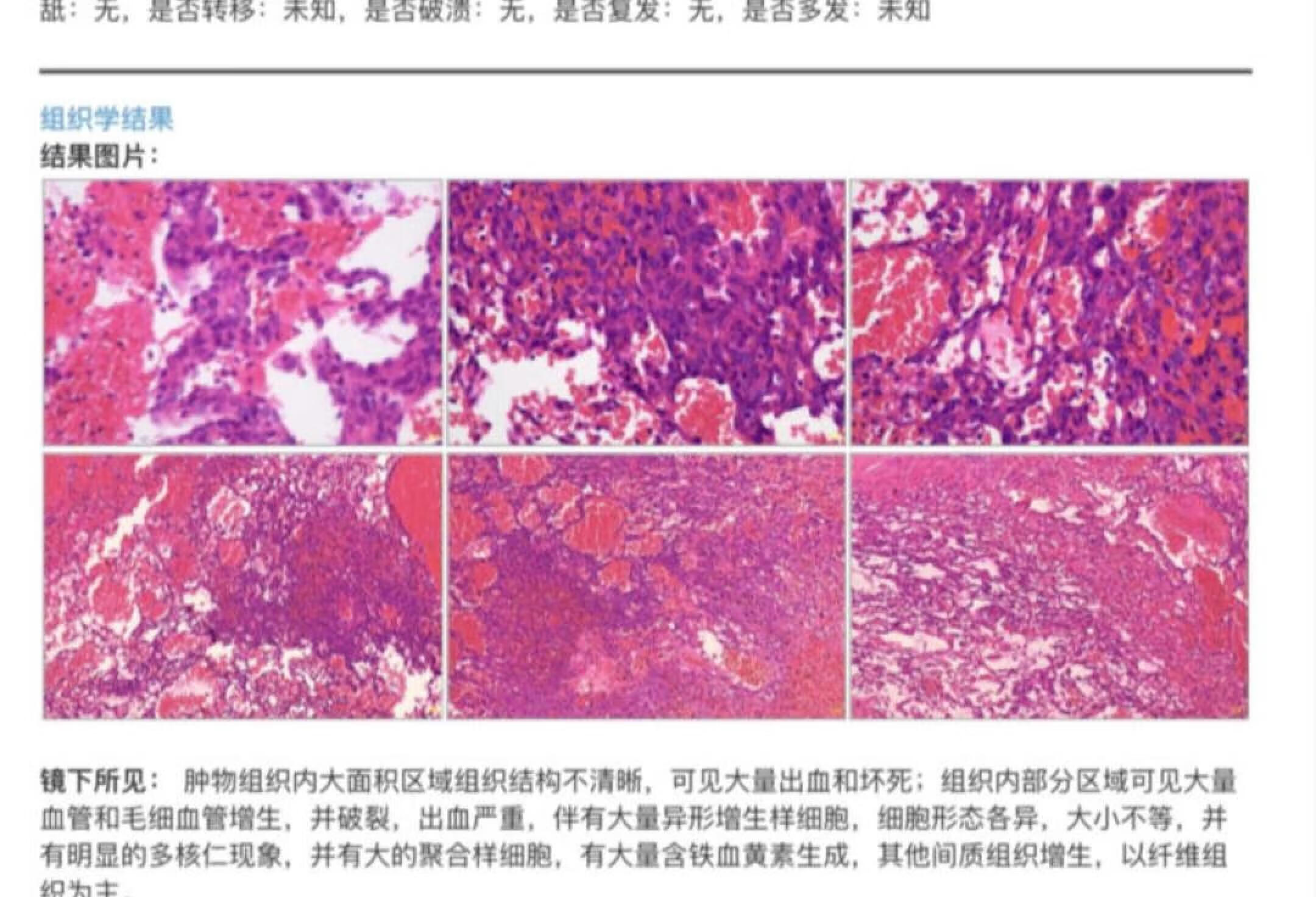 12岁金毛后腹膜腔血管肉瘤