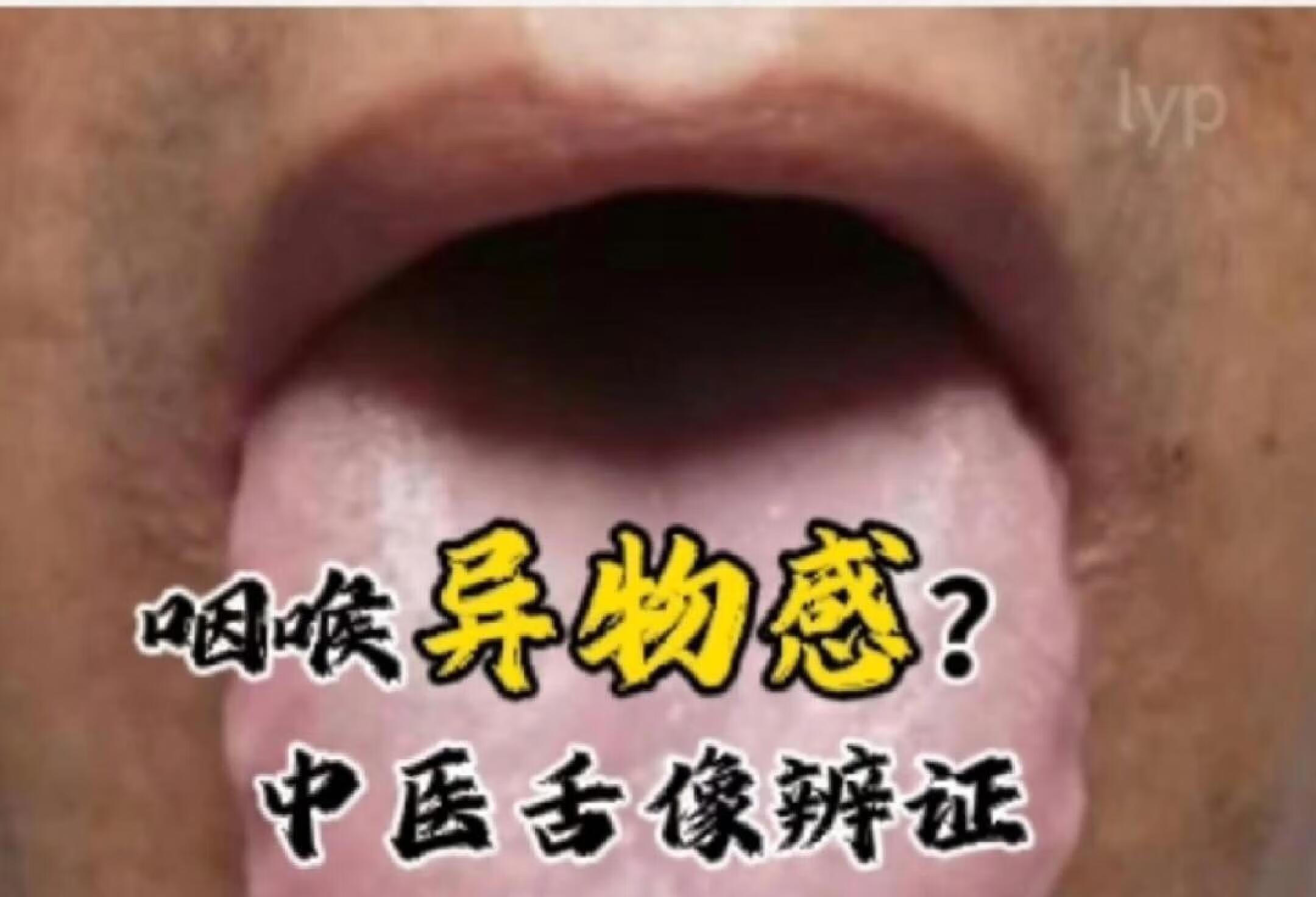 咽喉异物感有痰？康复还需重视一点！