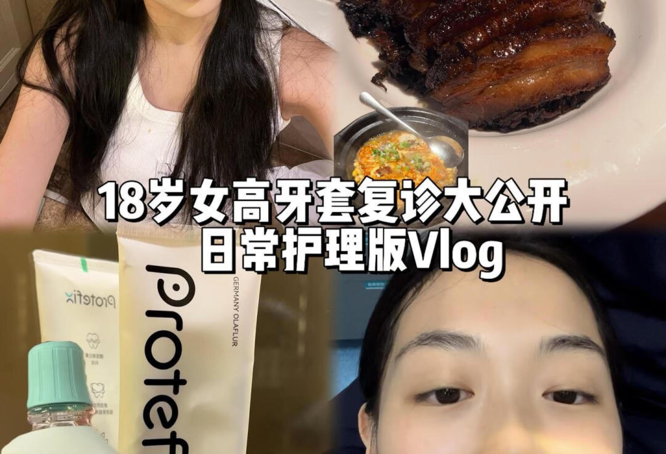 【Vlog】18岁女高牙套复诊*日常护理🦷