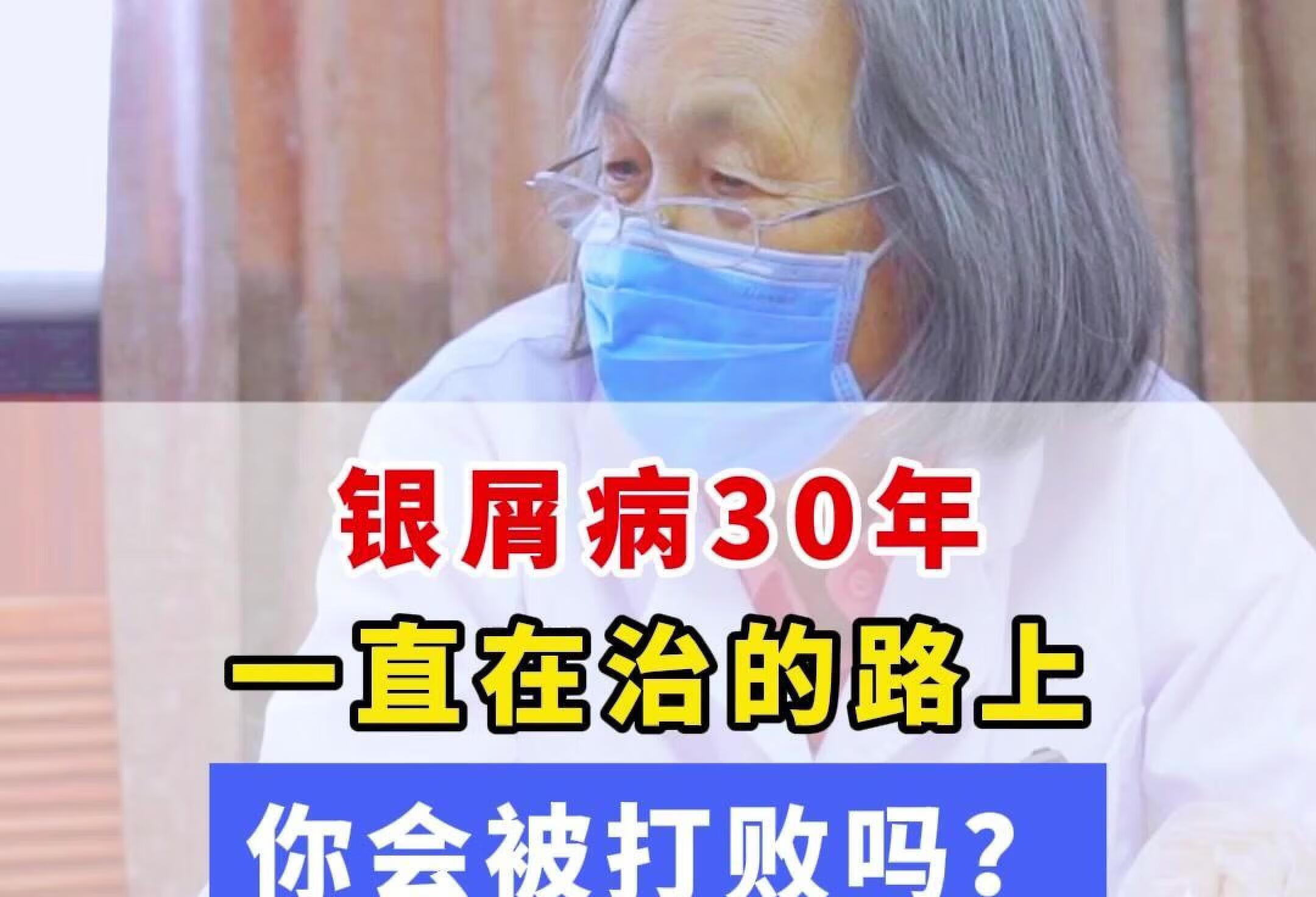 银屑病30年一直在治的路上，你被打败了吗？