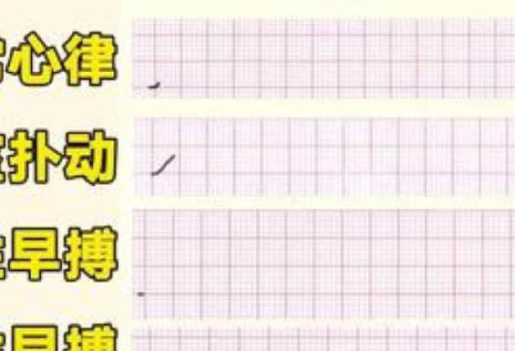 健康科普 房玉涛医生 心电图