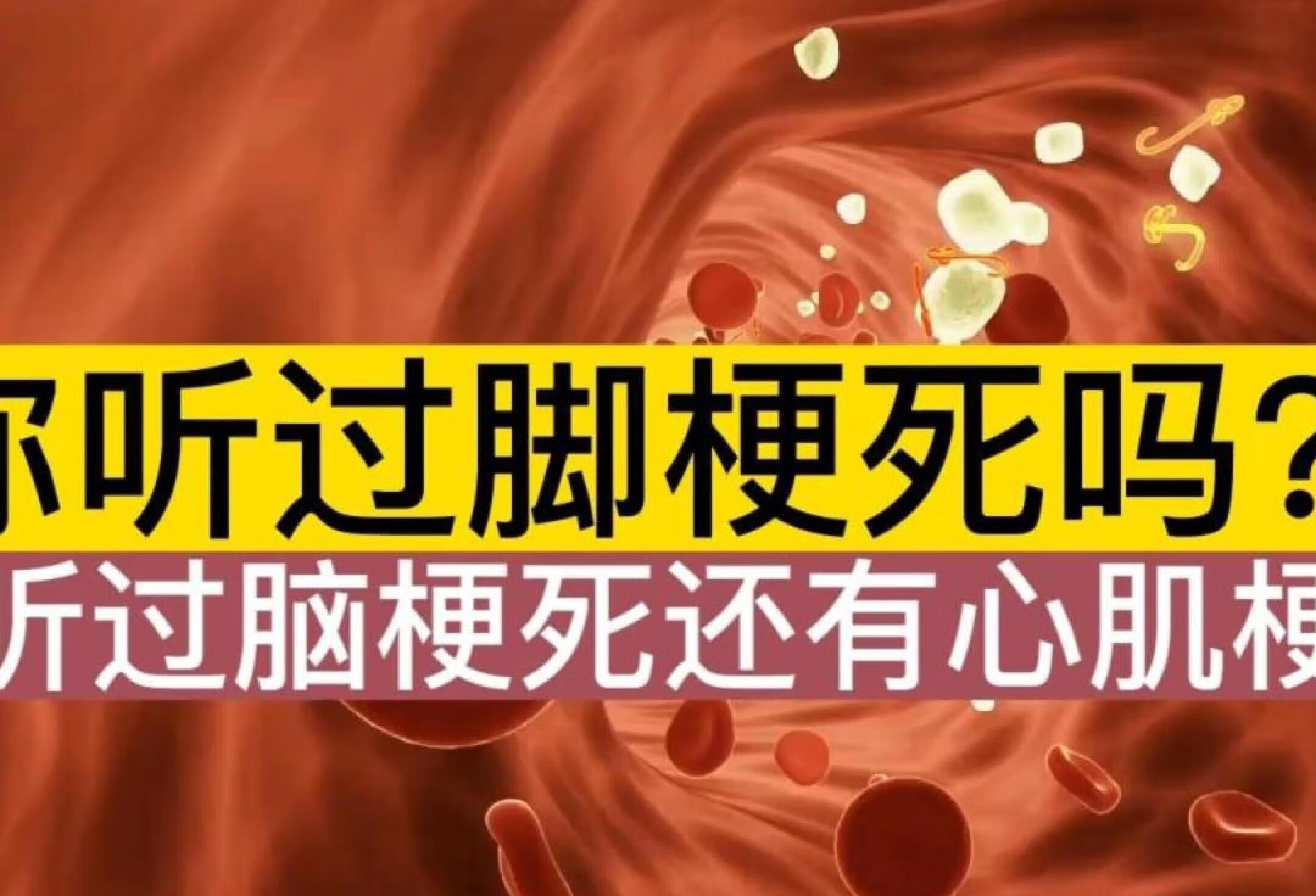 你听过脑梗死心肌梗死，但你听过脚梗死吗？