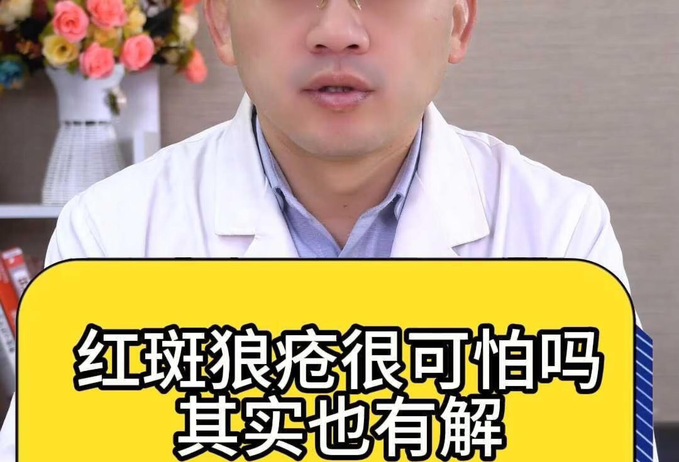 红斑狼疮很可怕吗其实也有解