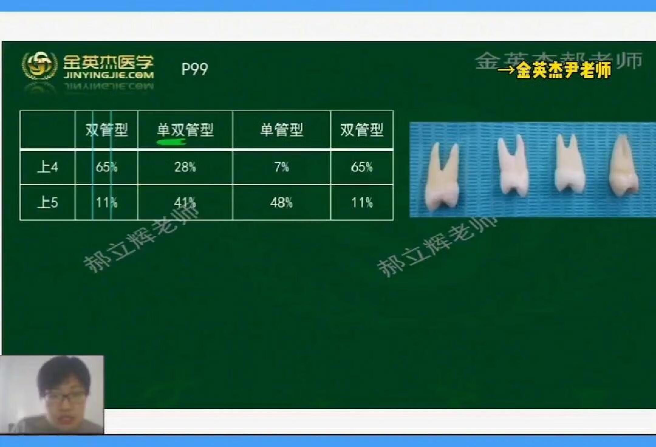 口腔助理｜口腔执业｜口腔解剖恒牙髓腔形态