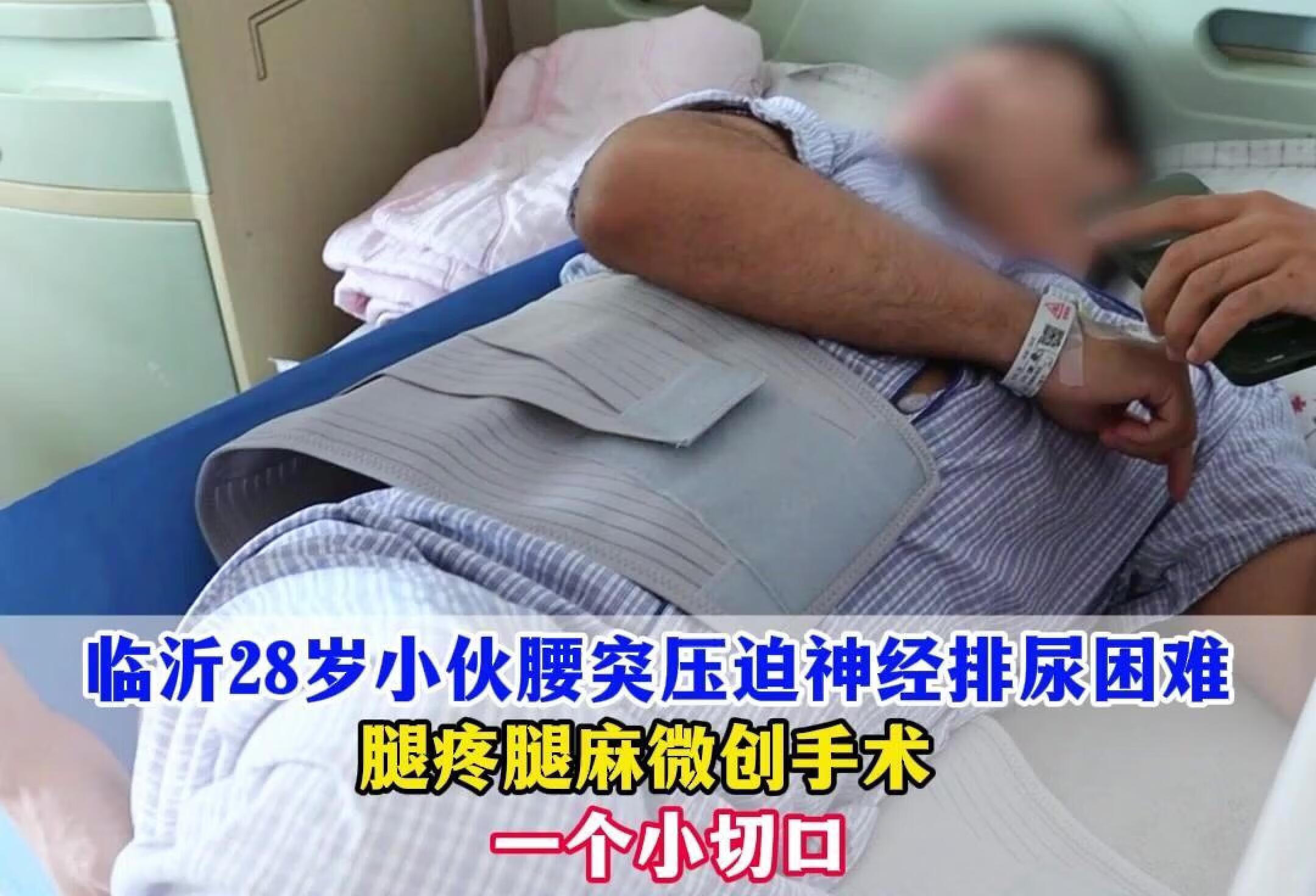 神经根型腰椎病