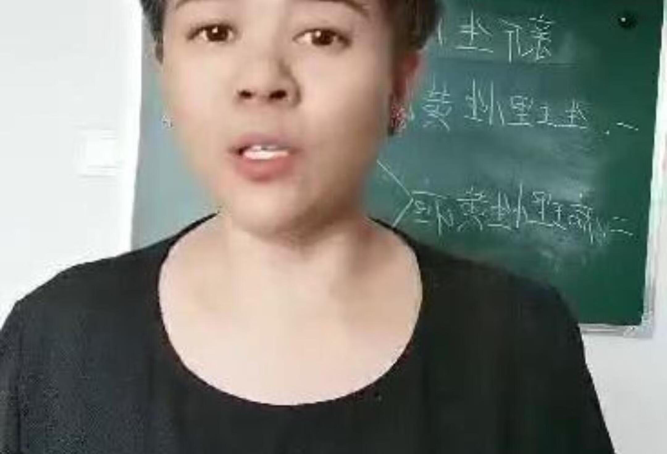 溶血性黄疸