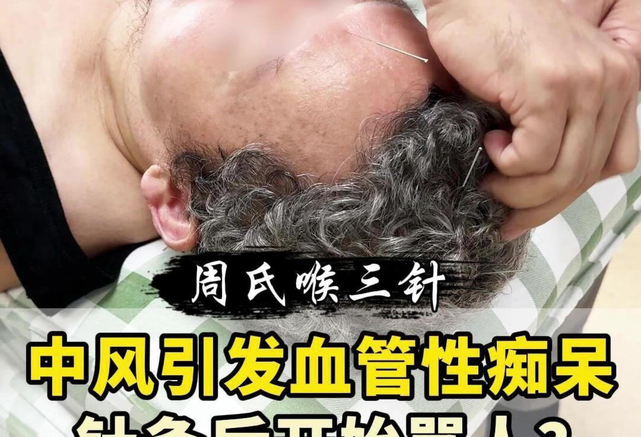 中风引发血管性痴呆，针灸后知道怎么骂人了