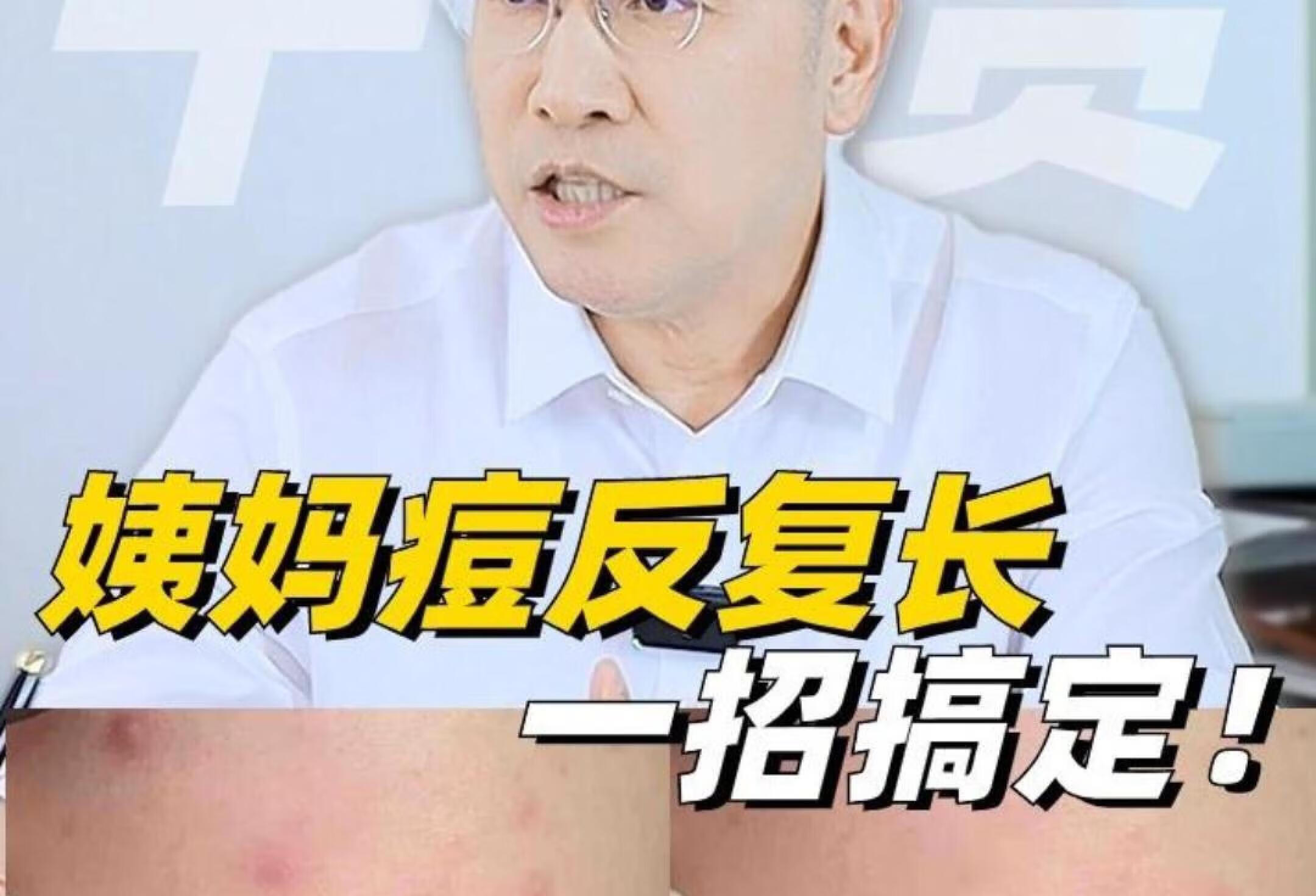 姨妈痘来得很准时？反复长？一招搞定！