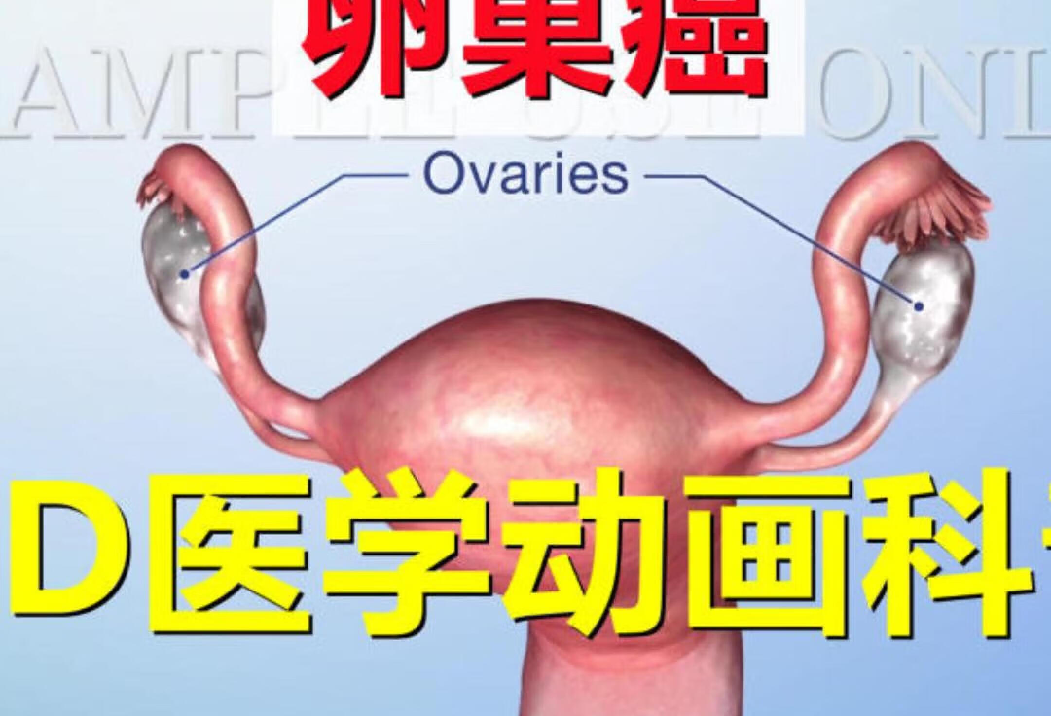 【3D医学动画科普】卵巢癌（中英双语字幕）