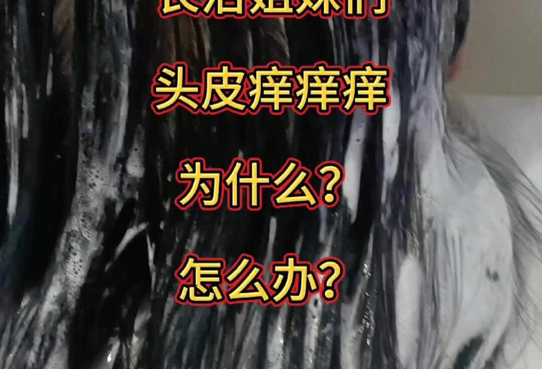 长治姐妹们，头皮痒痒痒，为什么？怎么办？