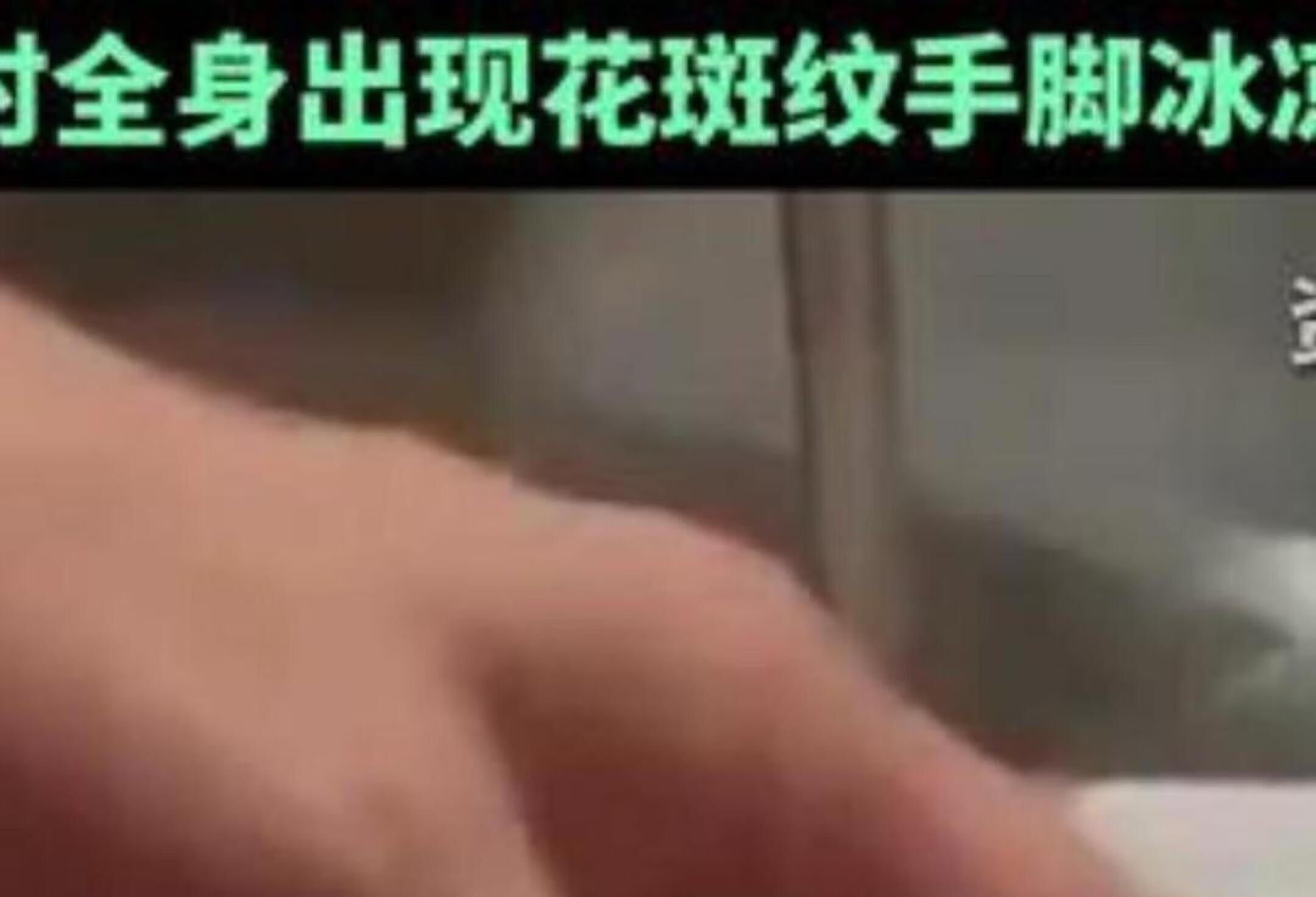 宝宝高烧用酒精擦身致休克，全身花斑发紫紧急送医！