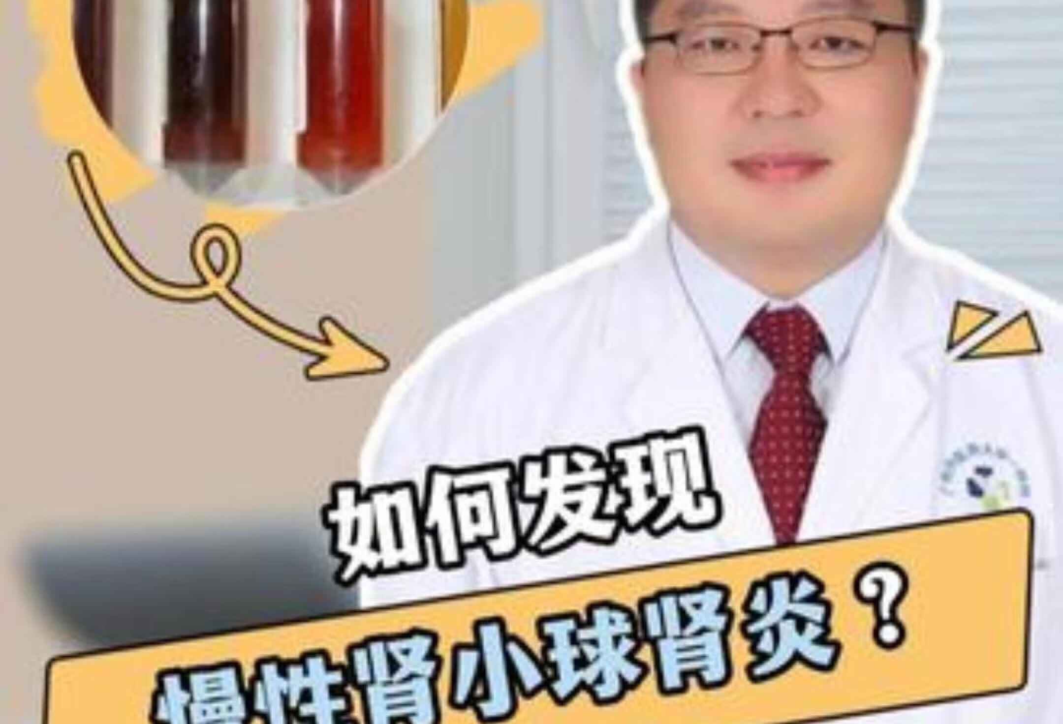 慢性肾小球炎怎么发现？专家教你健康防护