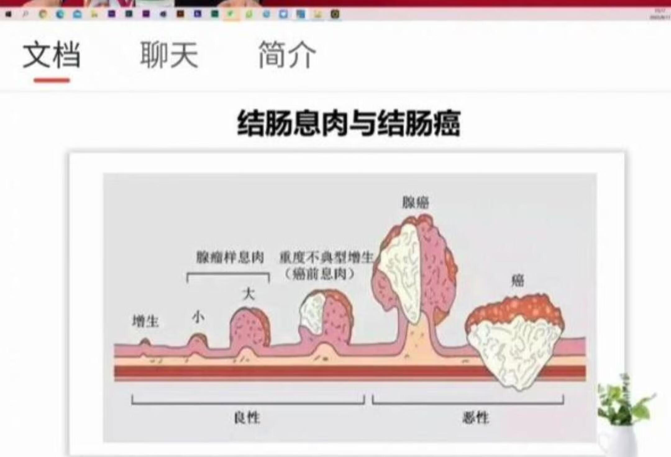 结肠息肉