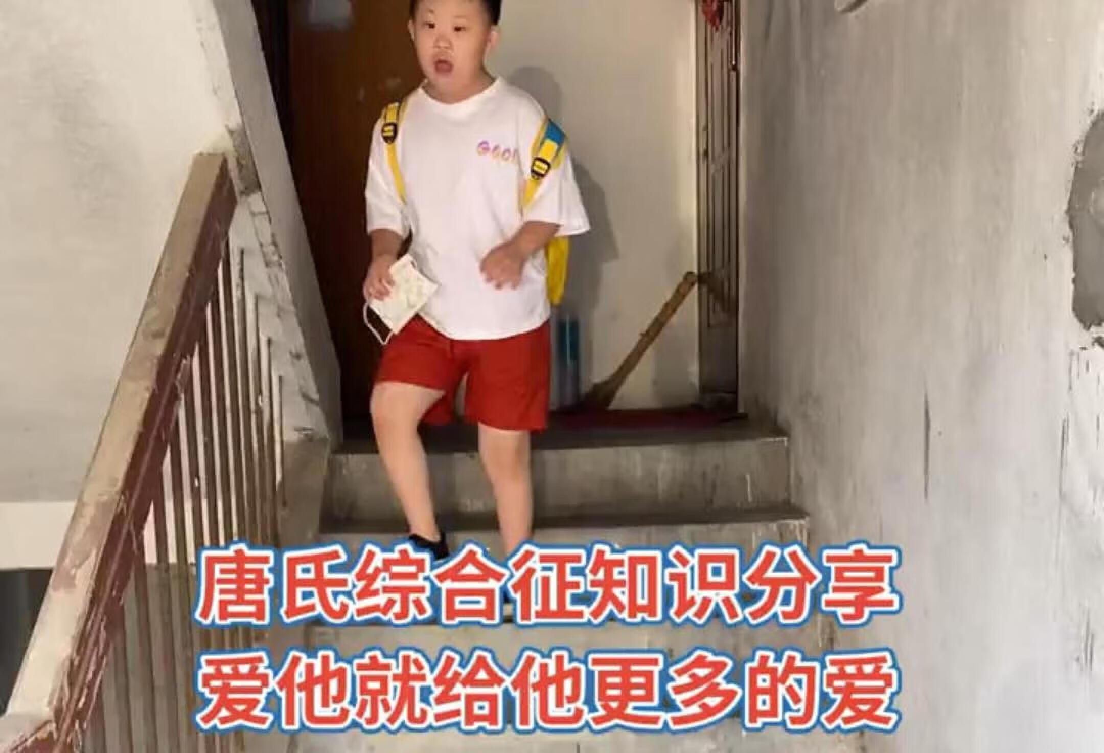 唐氏综合征～易位型染色体异常🧬