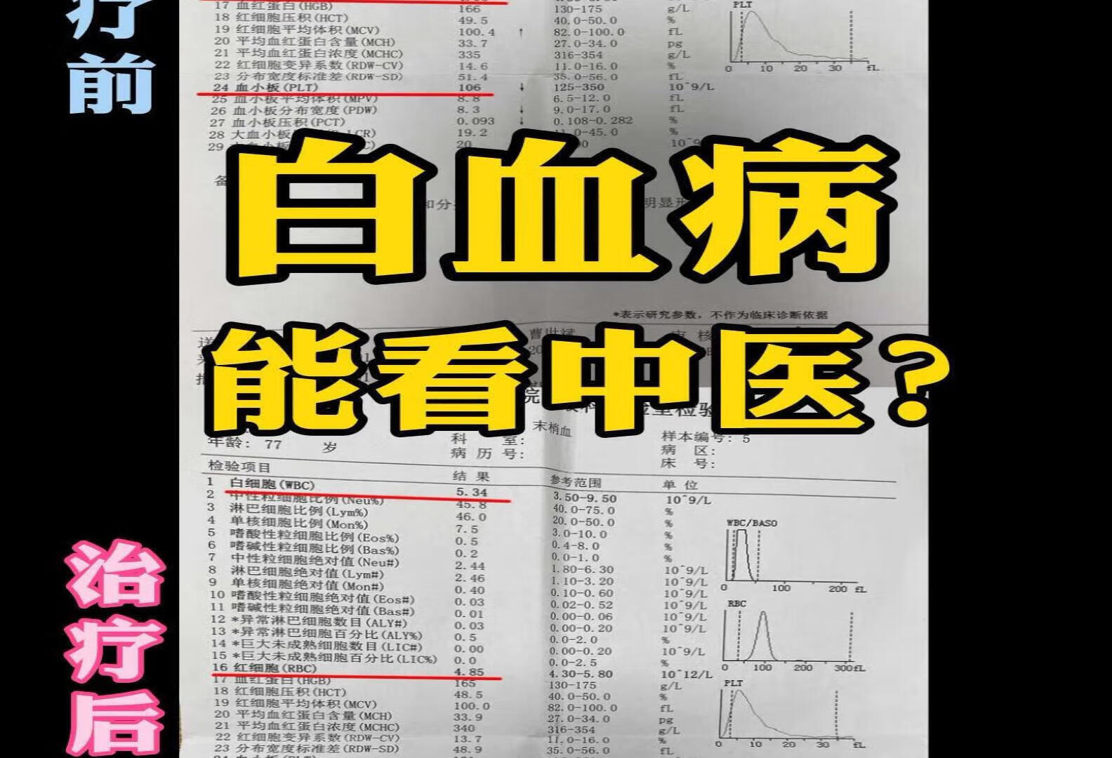 白血病，中医角度。