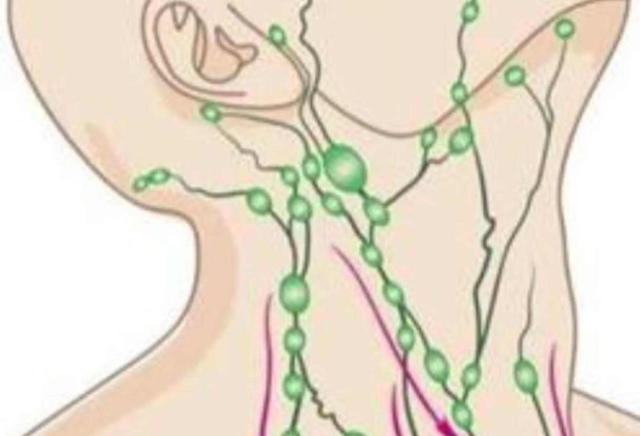 健康科普 医学科普 淋巴结 