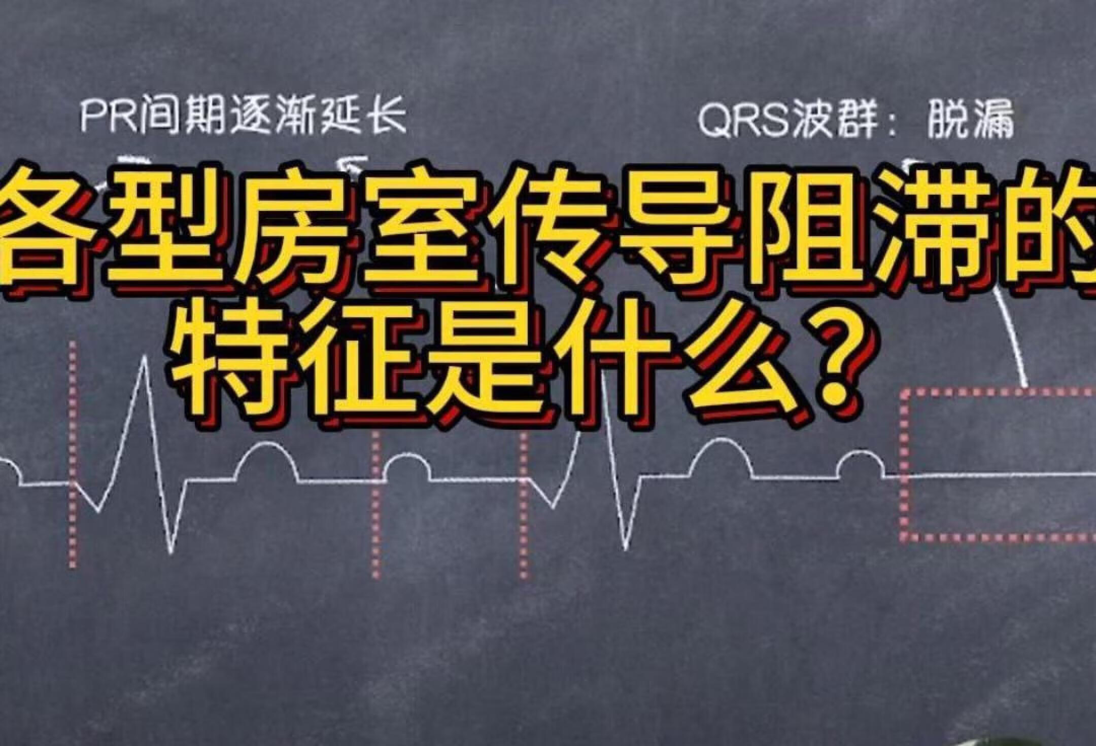 各型房室传导阻滞的特征是什么？