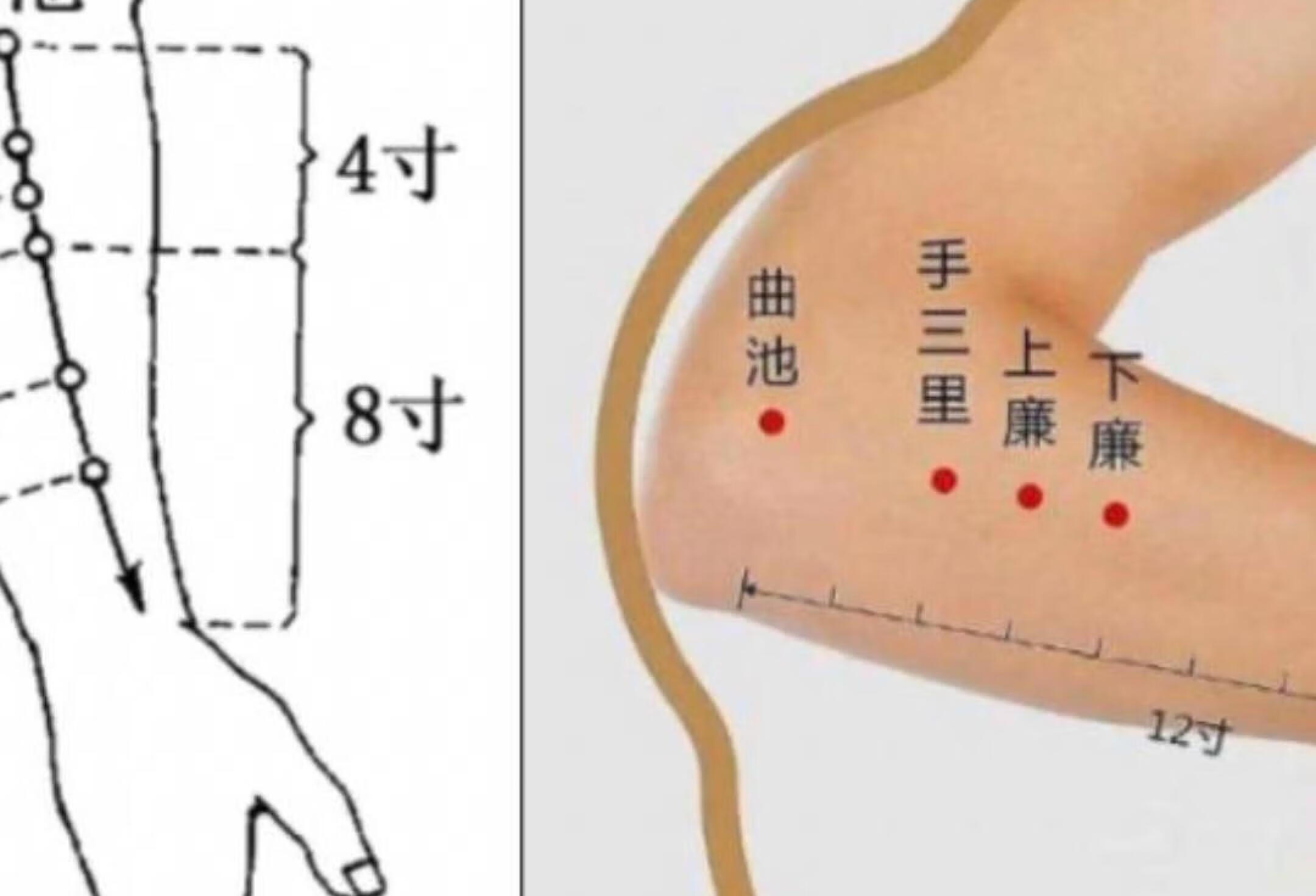 九玄小针略之86 甲沟炎4-4 小针方