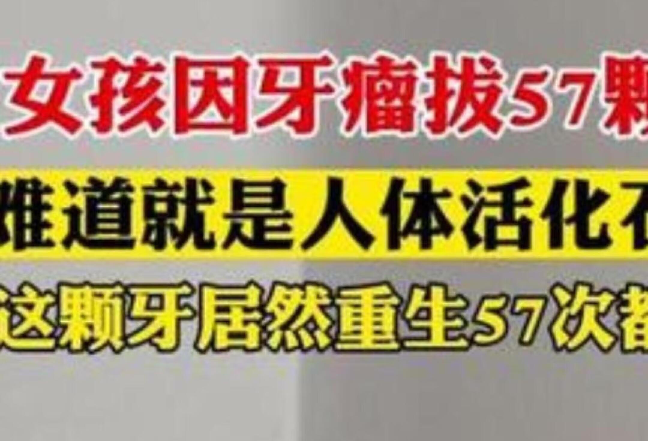 江苏23岁女孩拔掉57颗牙齿，惊呆网友