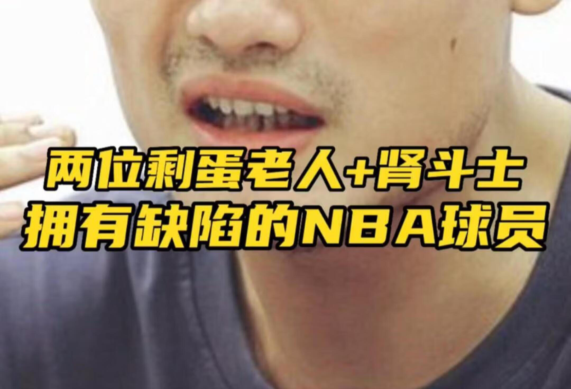 两位剩蛋老人+肾斗士！拥有缺陷的NBA球员！