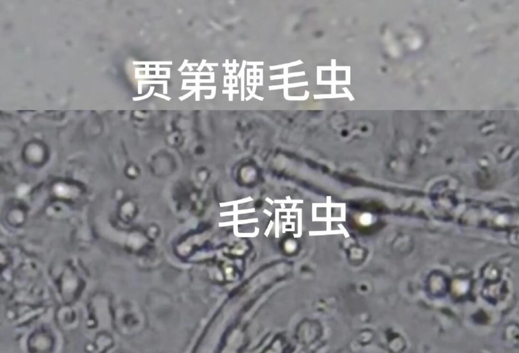 如何在高倍镜下区分贾第鞭毛虫和毛滴虫