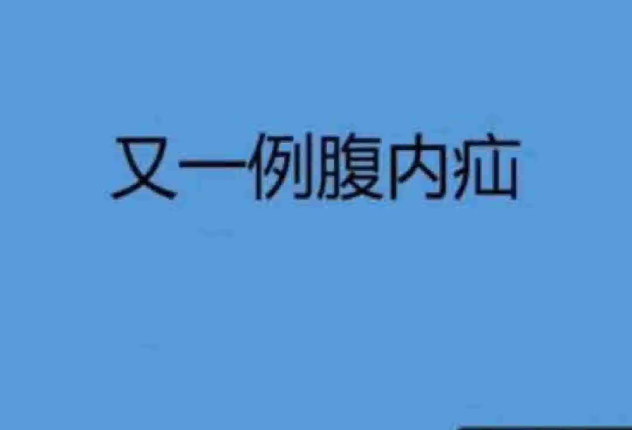 超声揭秘腹内疝，腹痛真相大白