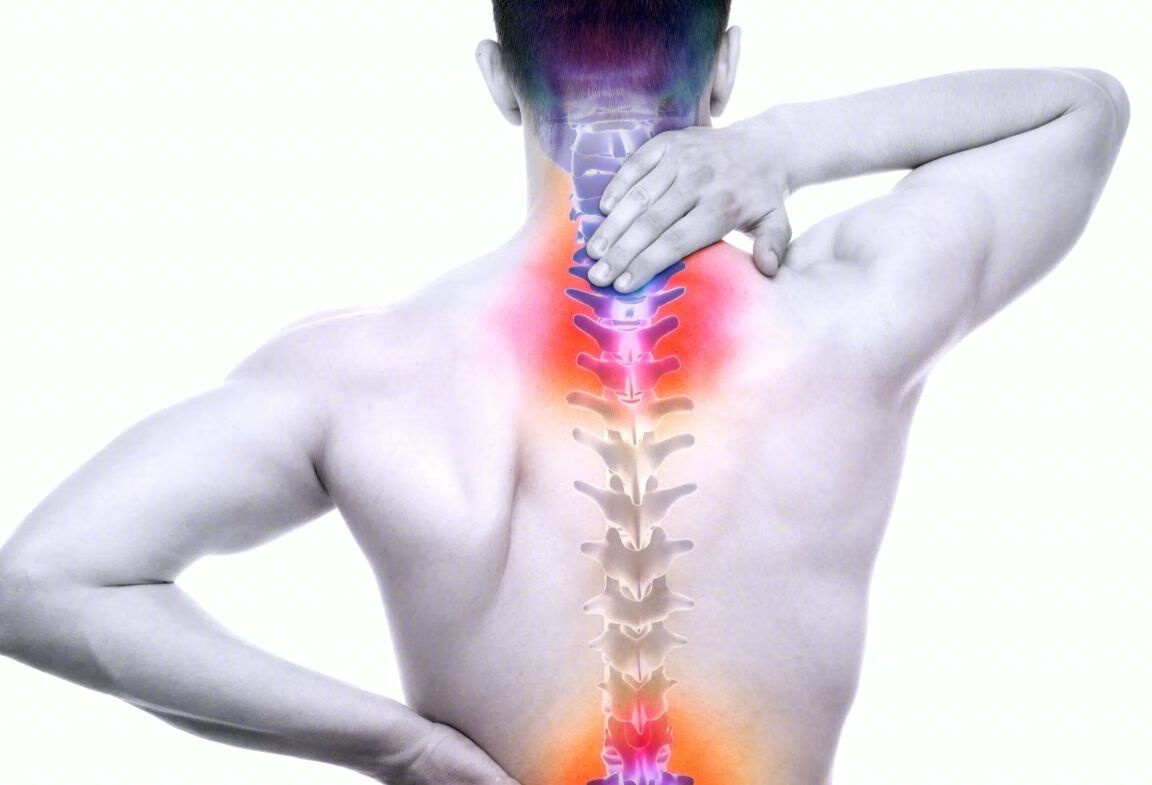 脊柱结核有哪些表现？如何治疗？
