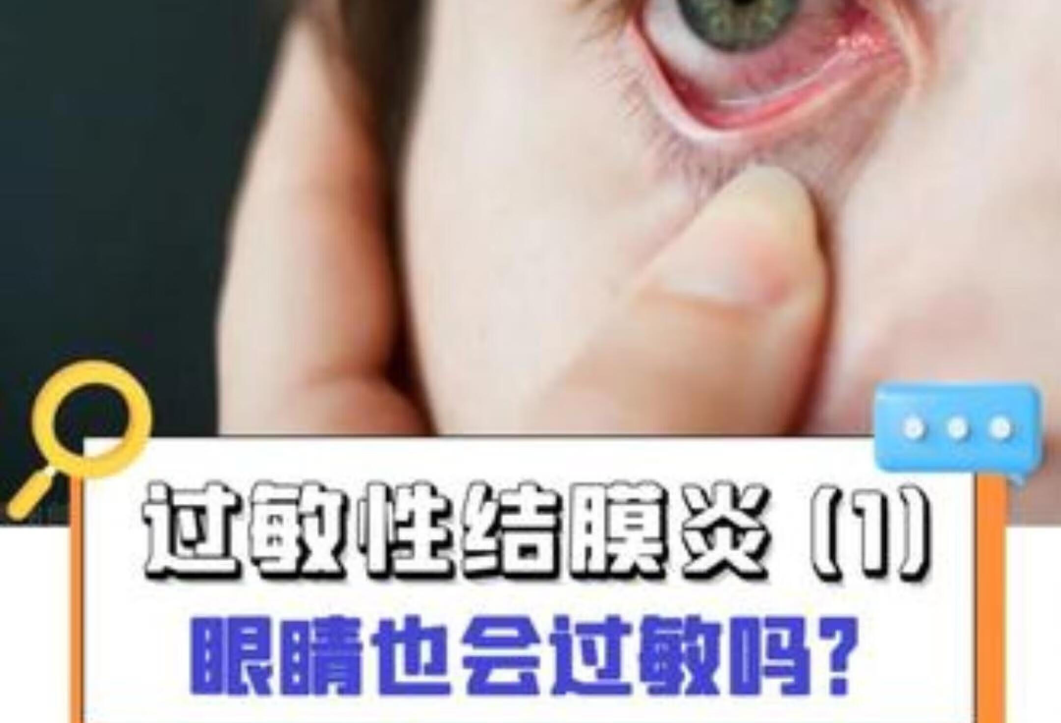 过敏性结膜炎速解，你了解几分？