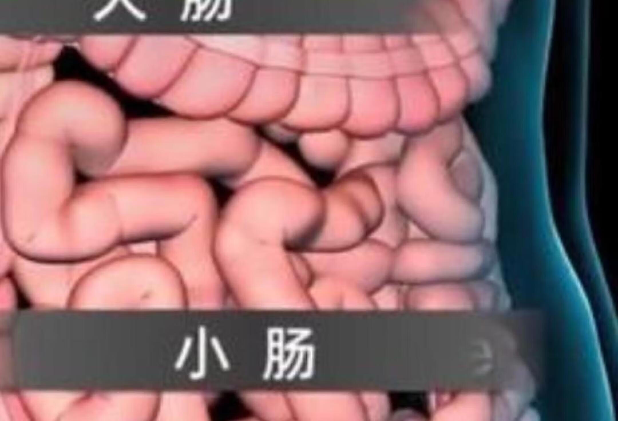 3D动画揭秘腹壁切口疝生成过程