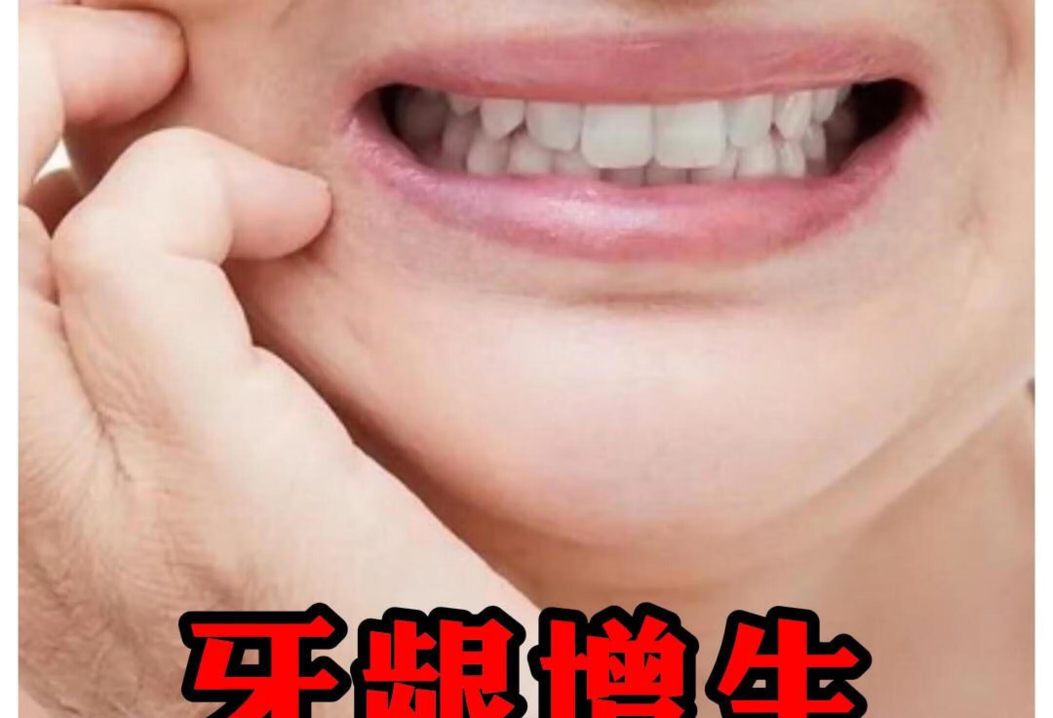 牙龈增生到底有多可怕