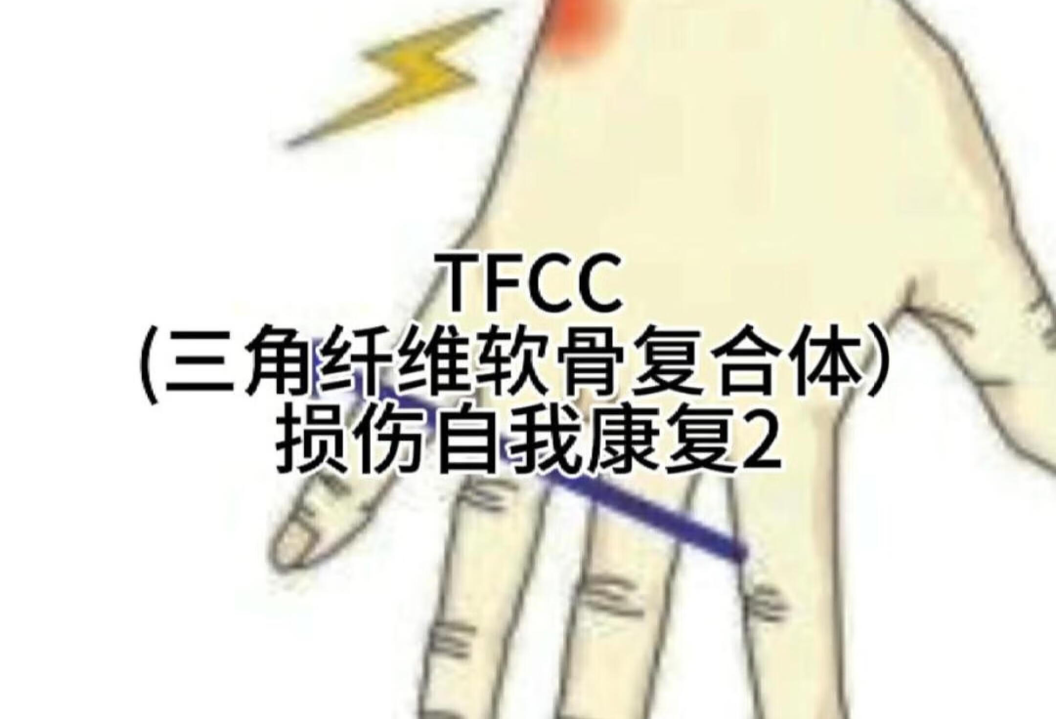 TFCC 三角纤维软骨复合体损伤自我康复2